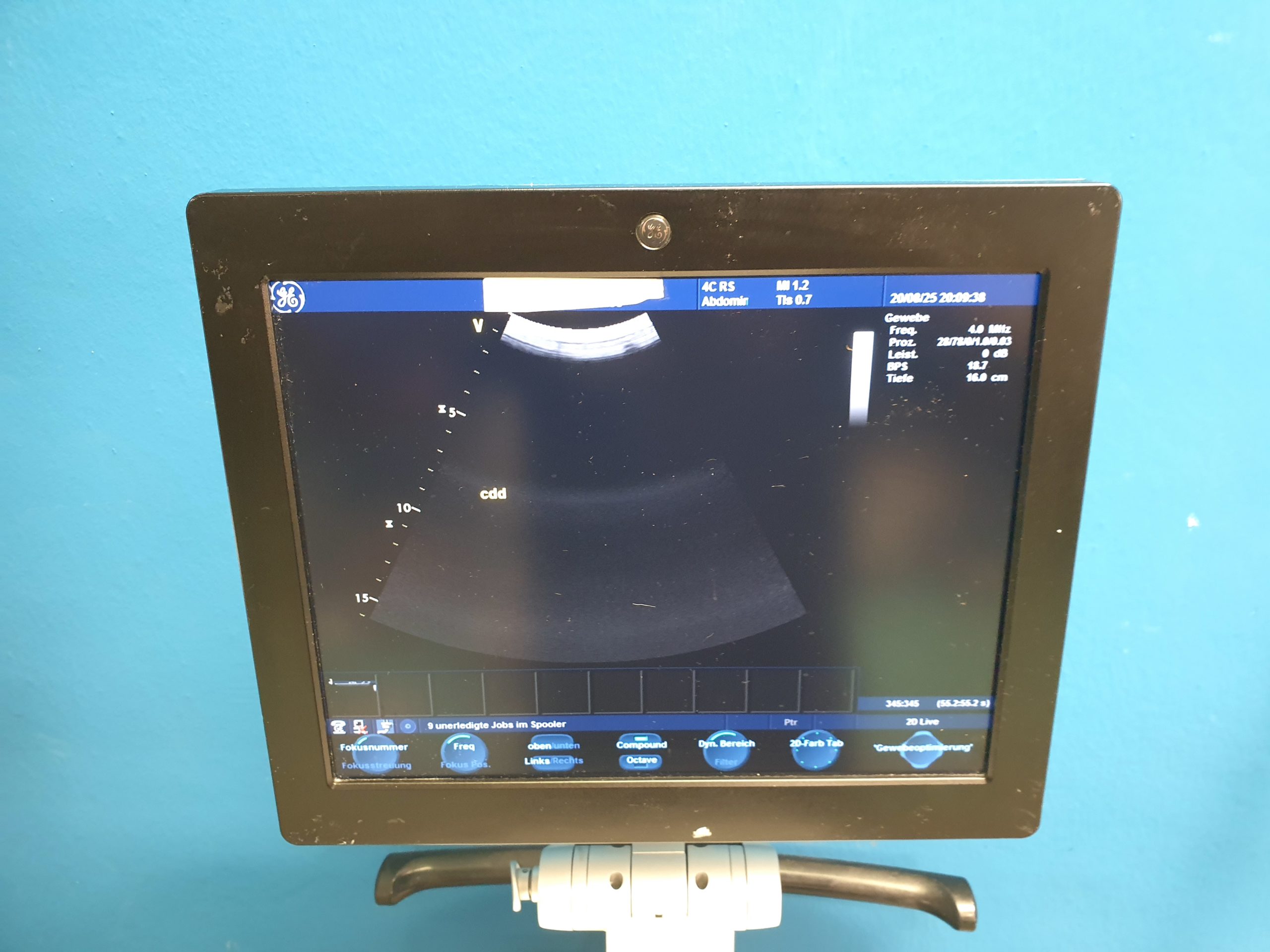 GE 4C-RS Convex Ultrasound Transducer thumbnail 2