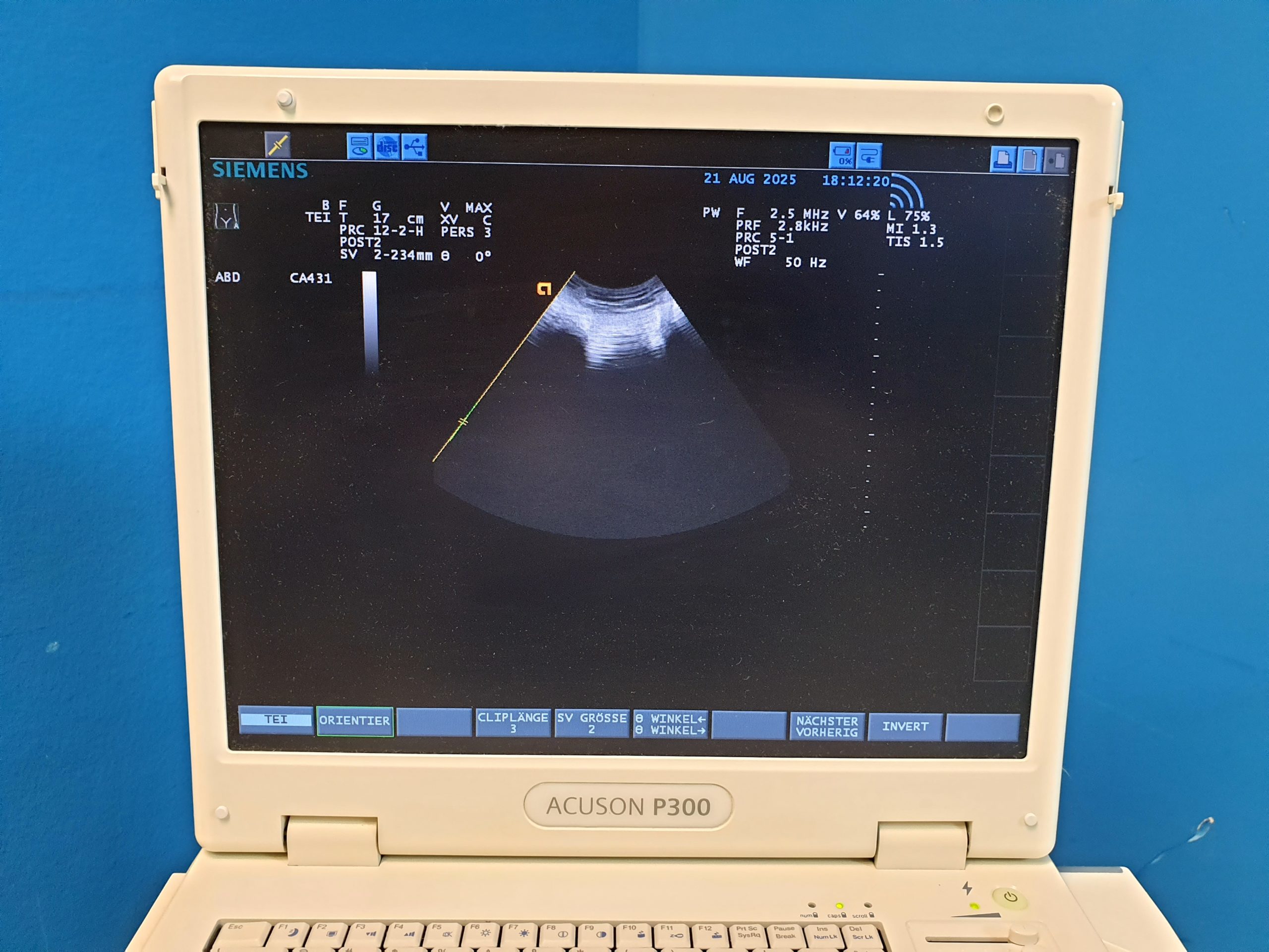 Siemens Acuson P300 P 300 – CA431 – PA230 – LA435 Tragbar Farbdoppler – Doppler thumbnail 6