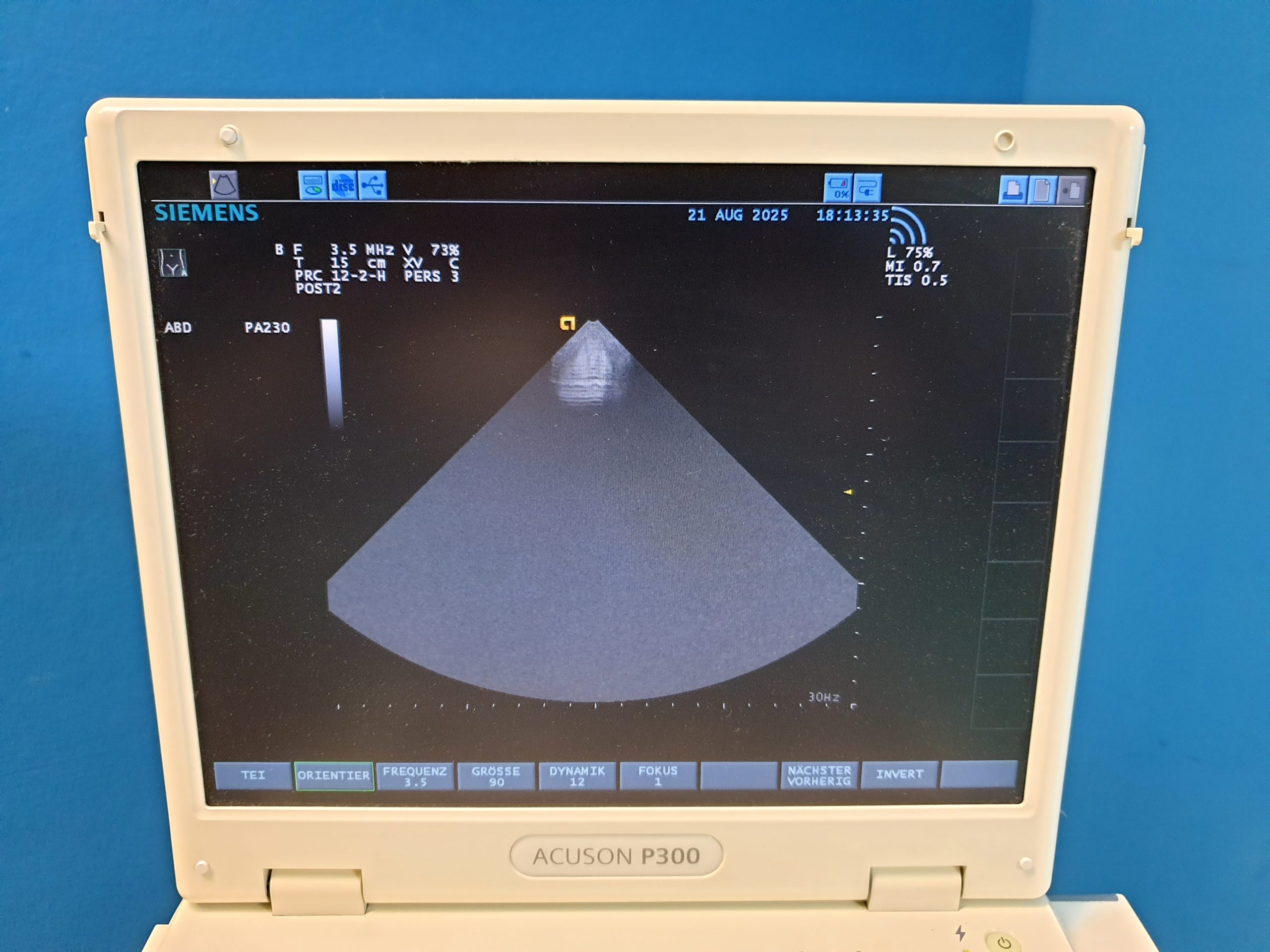 Siemens Acuson P300 P 300 – CA431 – PA230 – LA435 Tragbar Farbdoppler – Doppler thumbnail 11