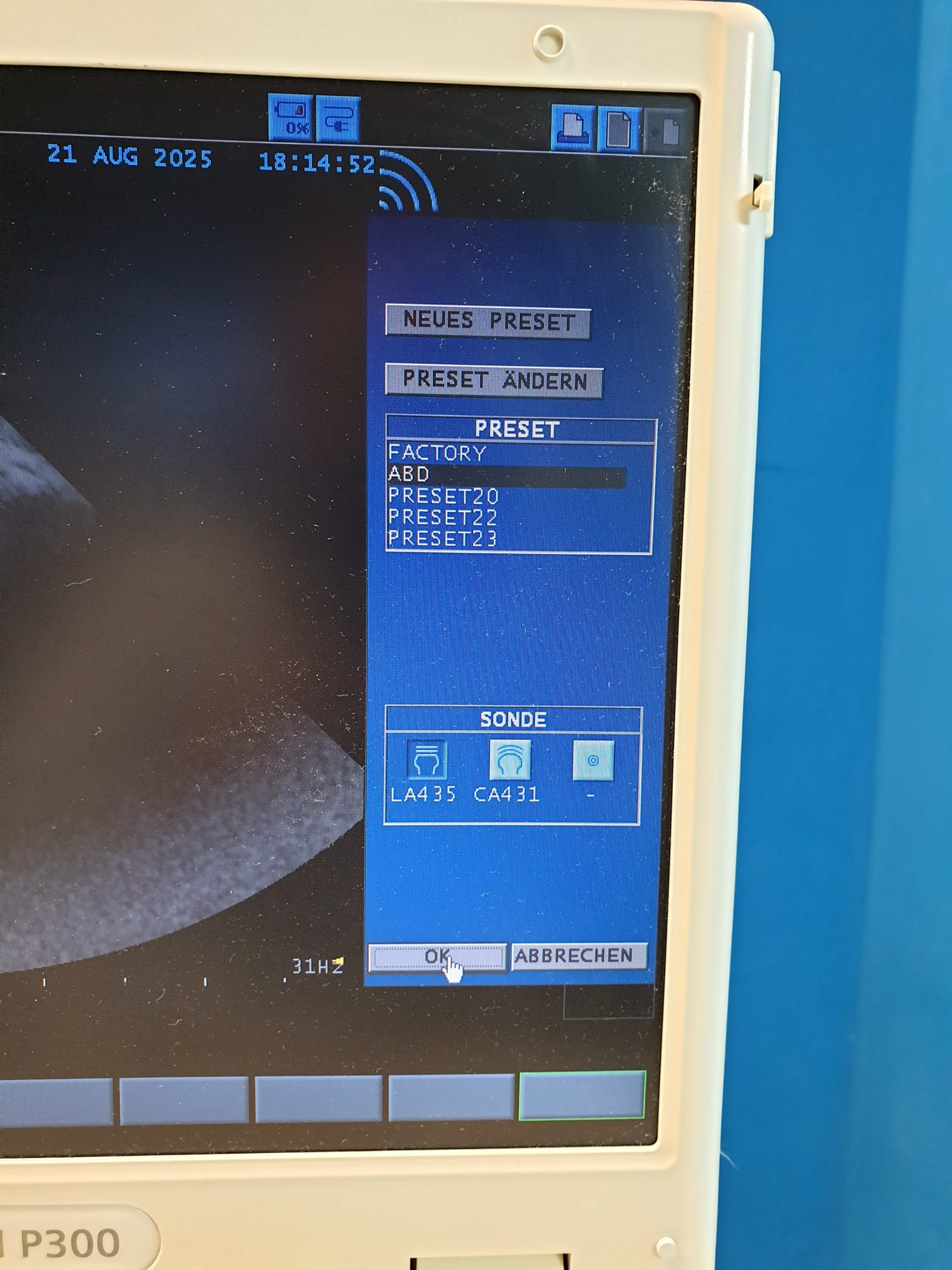 Siemens Acuson P300 P 300 – CA431 – PA230 – LA435 Tragbar Farbdoppler – Doppler thumbnail 12