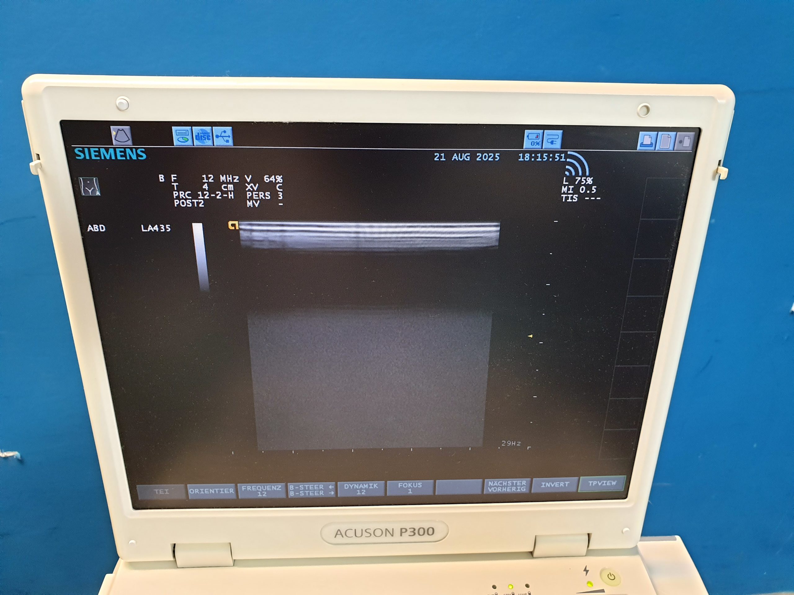 Siemens Acuson P300 P 300 – CA431 – PA230 – LA435 Tragbar Farbdoppler – Doppler thumbnail 15