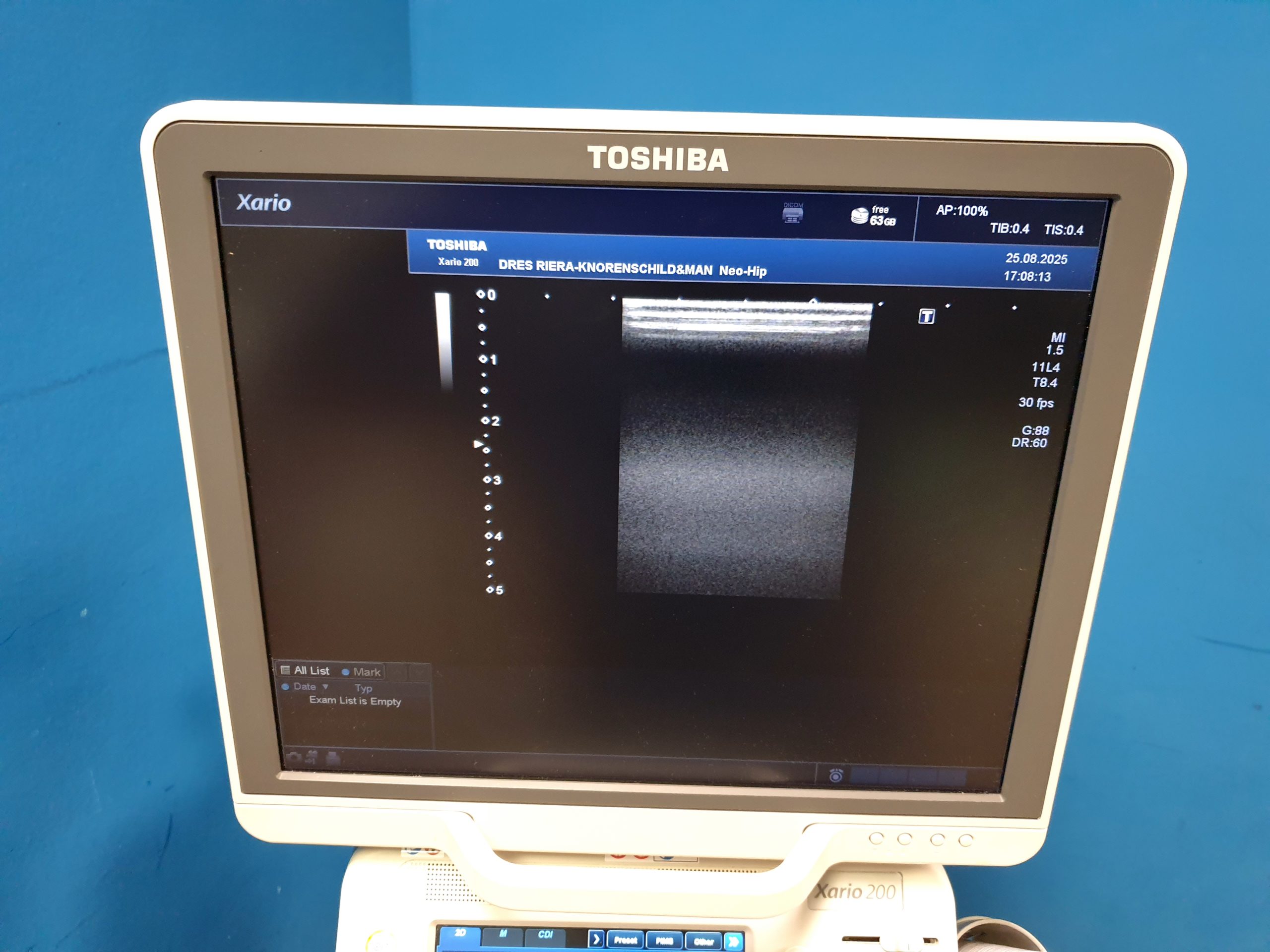Toshiba Xario 200 (TUS-X200) – 6C1 – 5S1 – 11L4 – Kardiomaschine DOM 2015 thumbnail 8