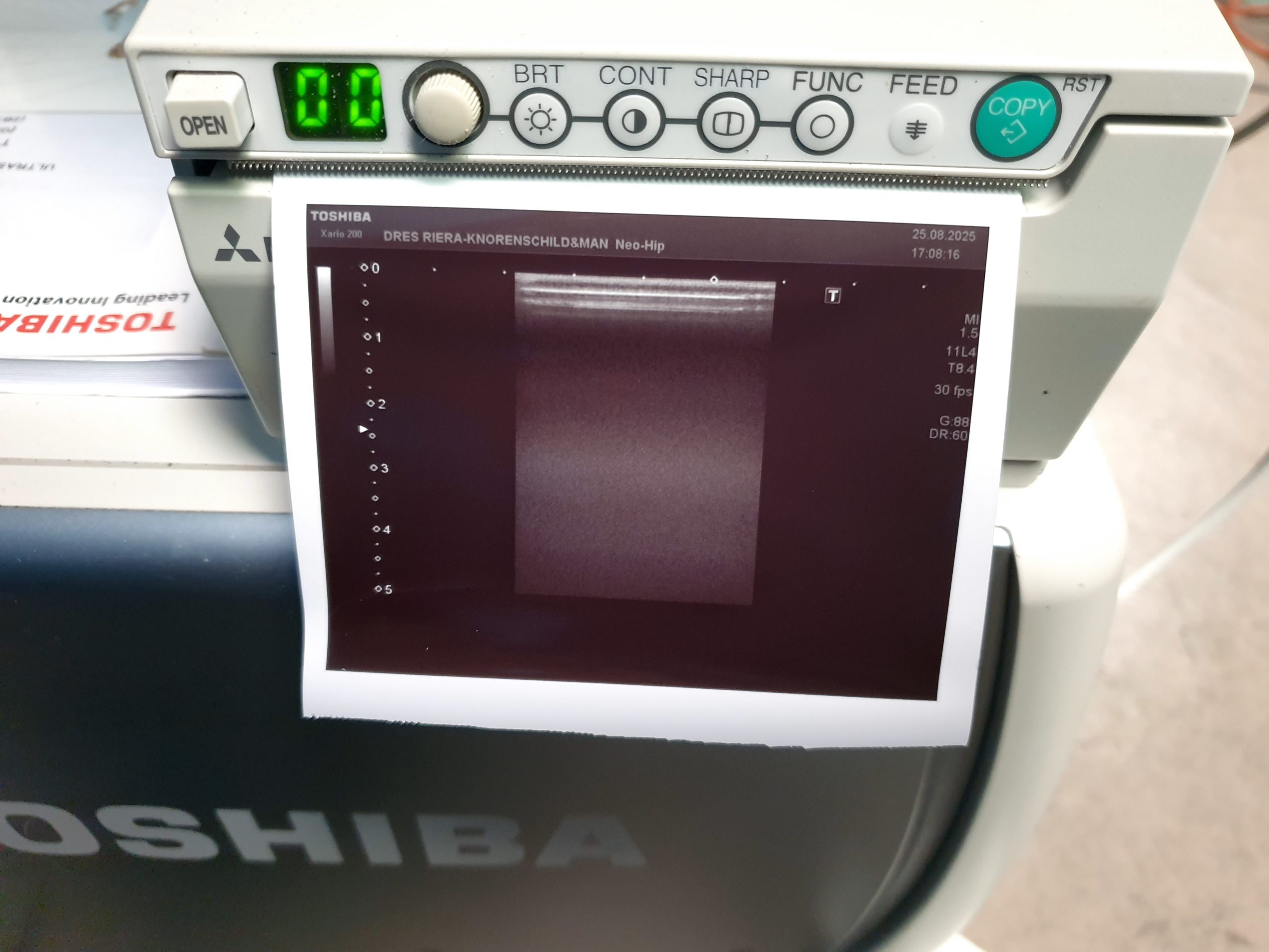 Toshiba Xario 200 (TUS-X200) – 6C1 – 5S1 – 11L4 – Kardiomaschine DOM 2015 thumbnail 9