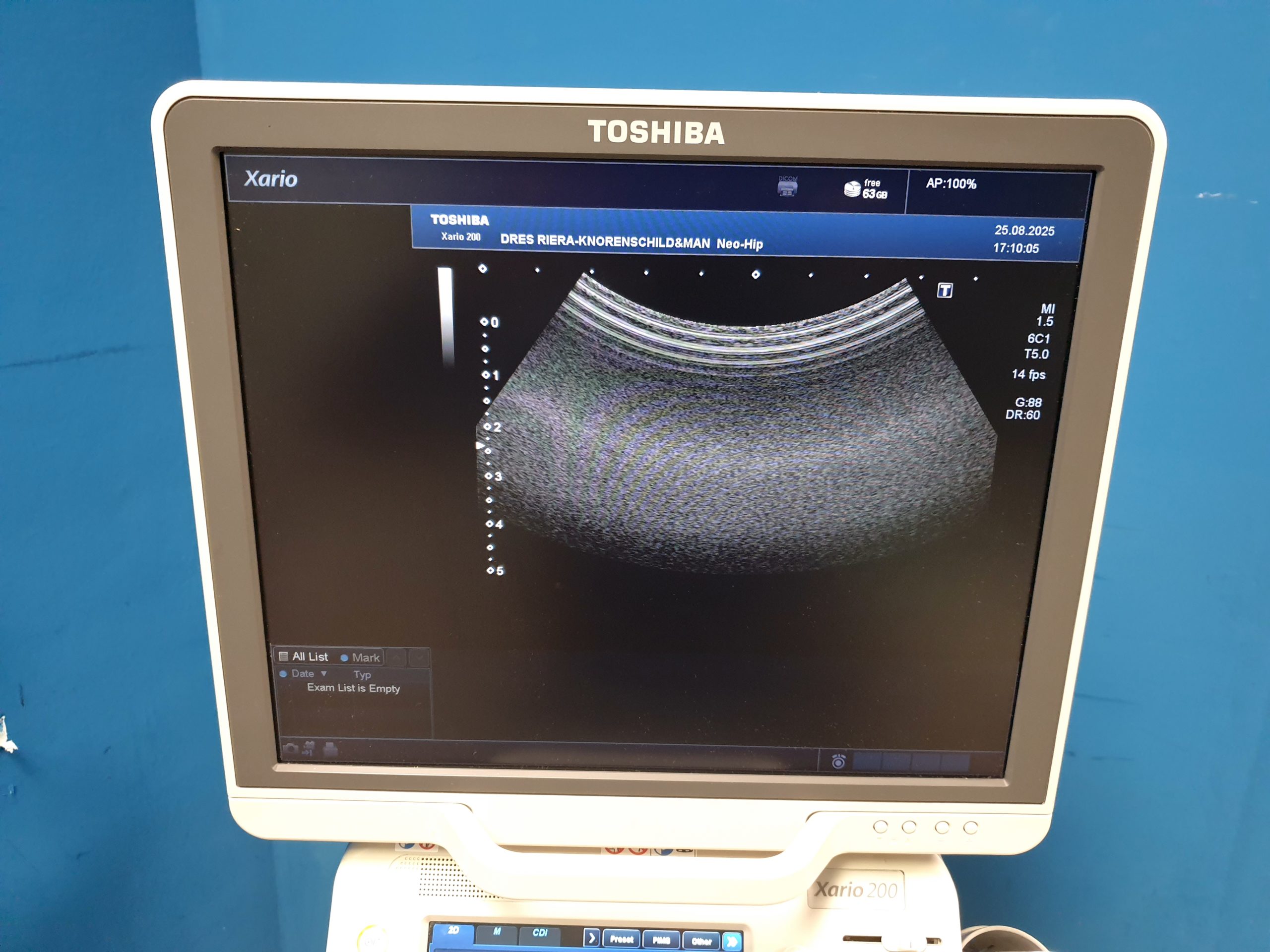 Toshiba Xario 200 (TUS-X200) – 6C1 – 5S1 – 11L4 – Kardiomaschine DOM 2015 thumbnail 12