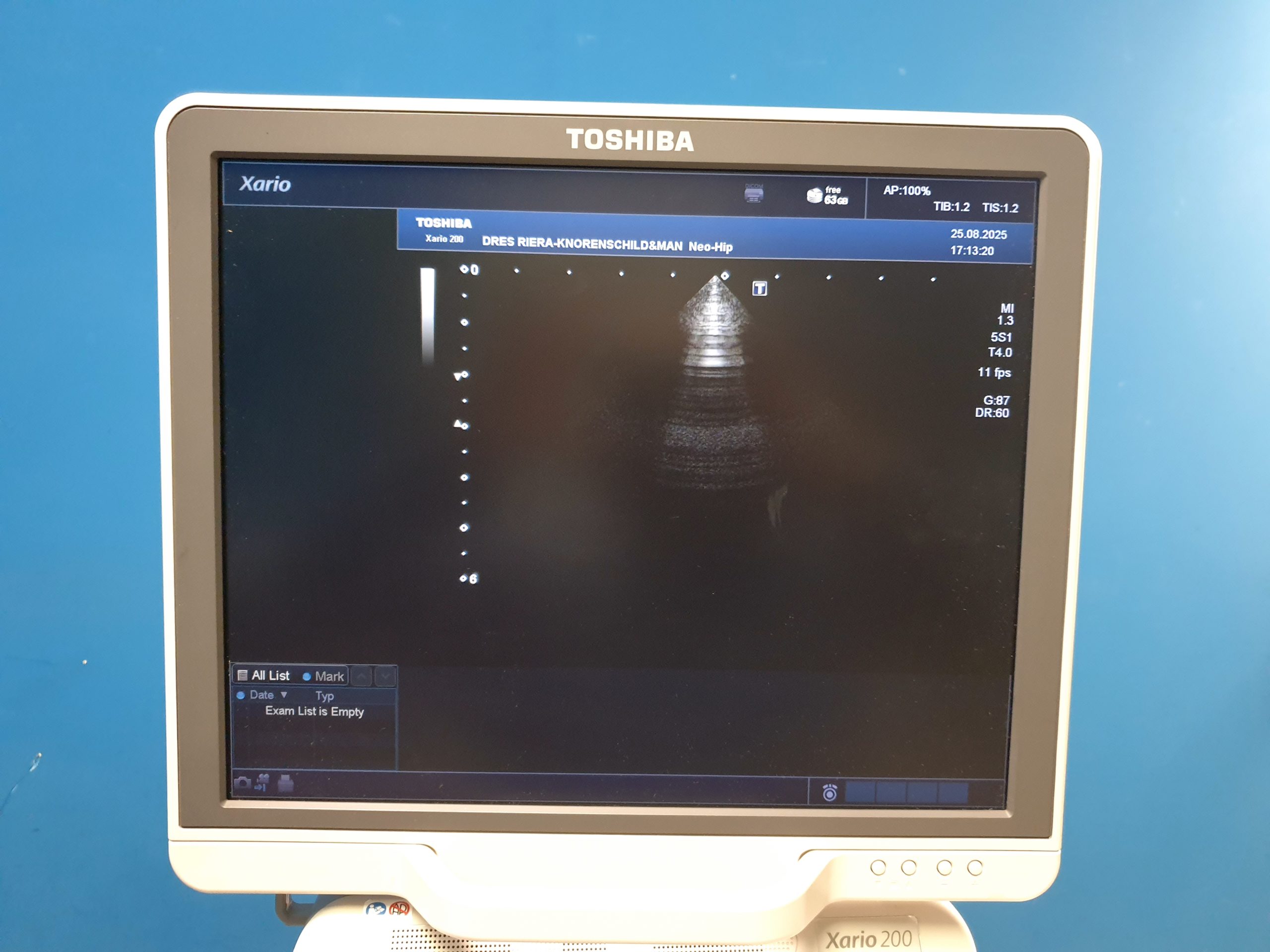 Toshiba Xario 200 (TUS-X200) – 6C1 – 5S1 – 11L4 – Kardiomaschine DOM 2015 thumbnail 18