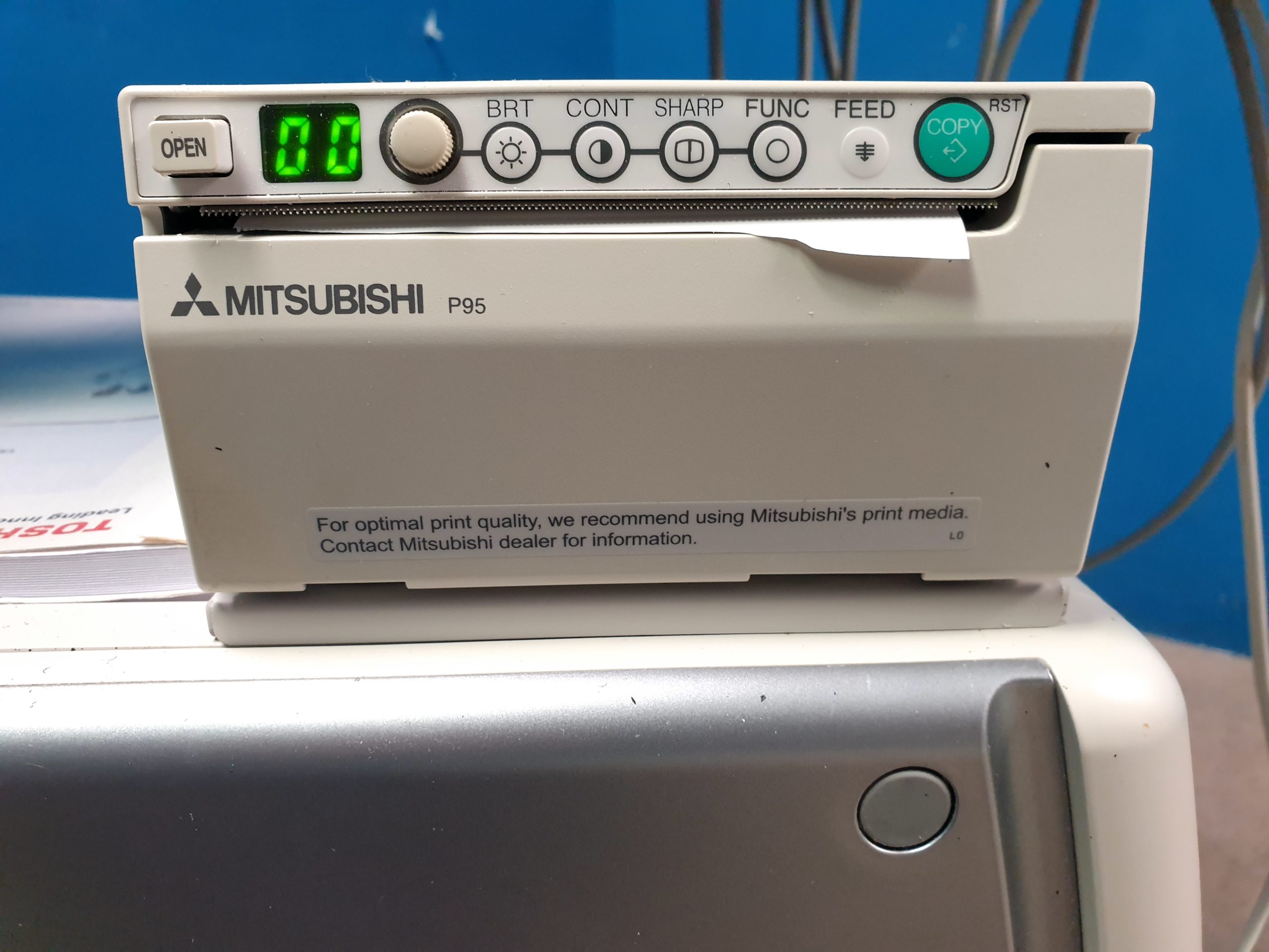 Toshiba Xario 200 (TUS-X200) – 6C1 – 5S1 – 11L4 – Kardiomaschine DOM 2015 thumbnail 20
