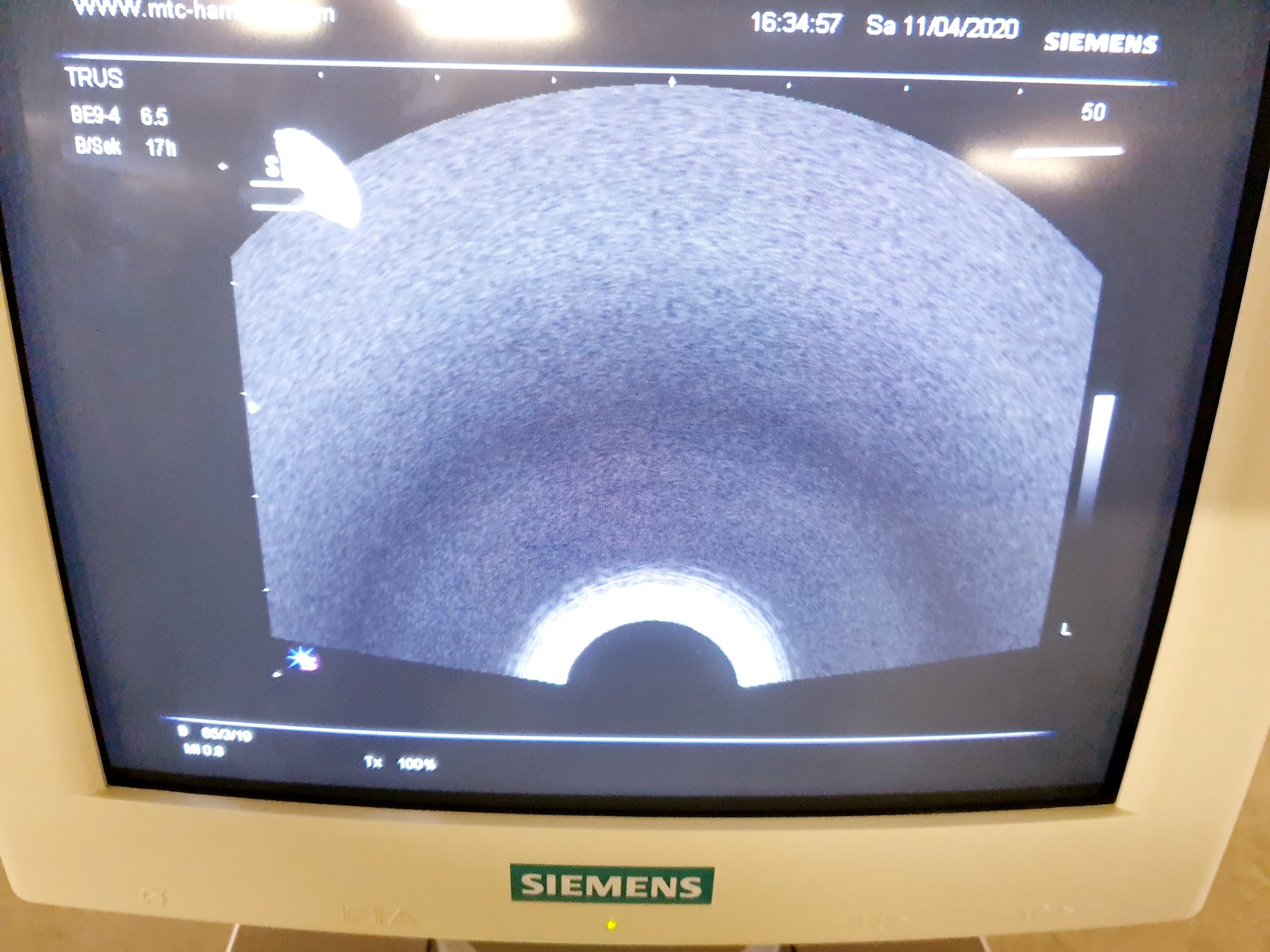 Siemens BE9-4 Transducer, Probe for Acuson and Sonoline thumbnail 2