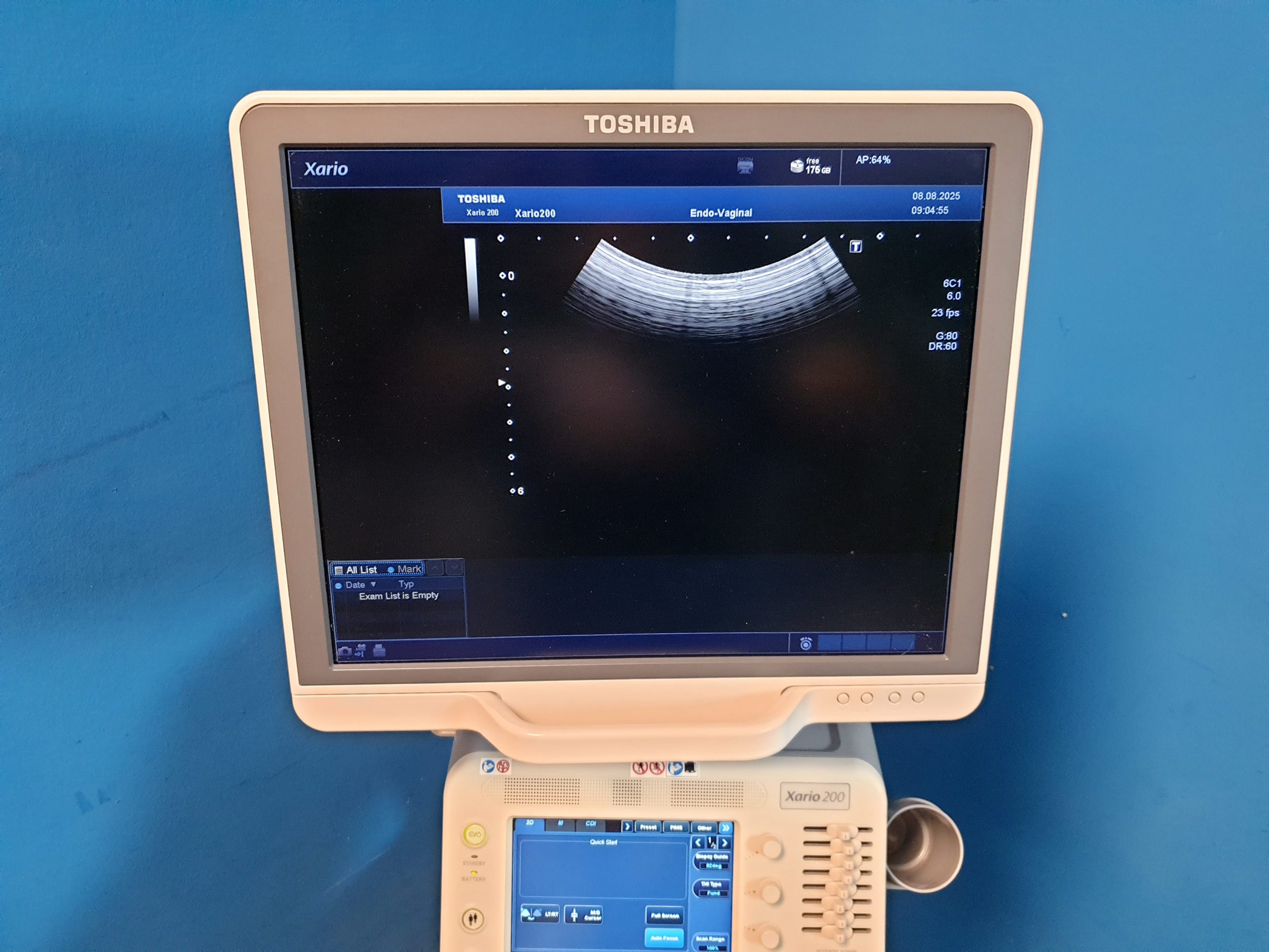 Toshiba TUS-X200 Xario 200 + 6C1 + 11C3 + 18L7 Konvex Linear Endovaginal – DOM2015 thumbnail 9