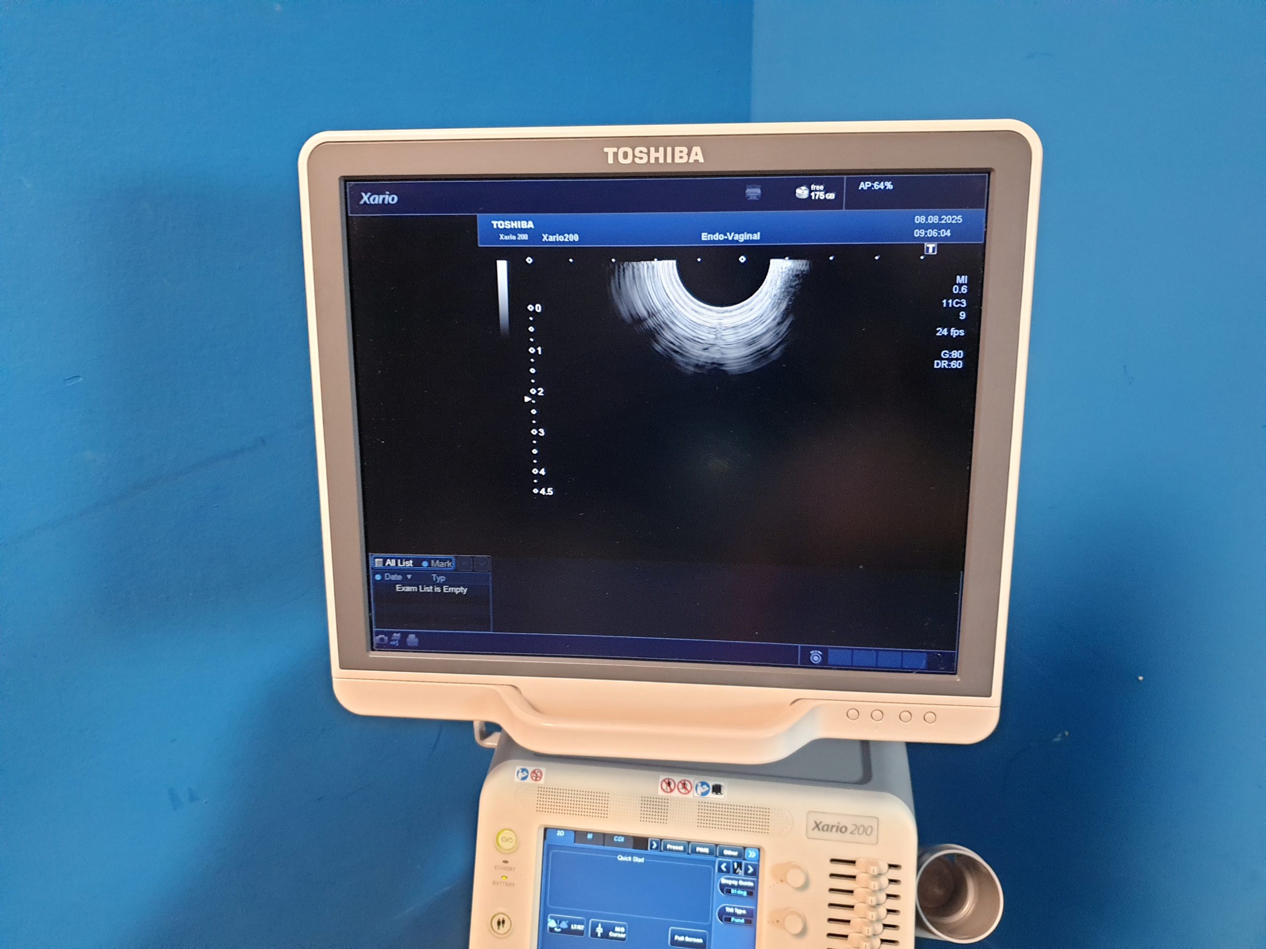 Toshiba TUS-X200 Xario 200 + 6C1 + 11C3 + 18L7 Konvex Linear Endovaginal – DOM2015 thumbnail 11