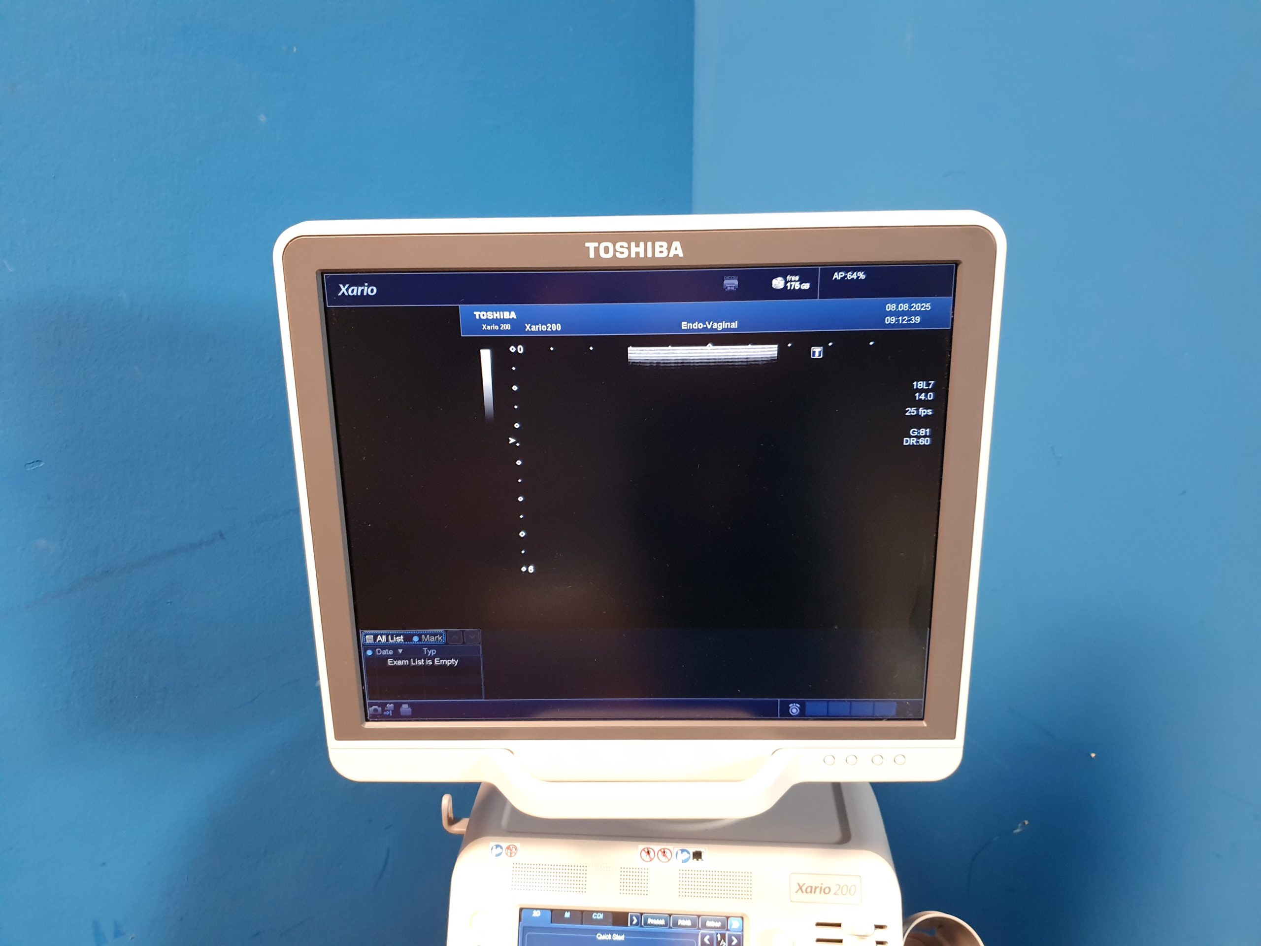 Toshiba TUS-X200 Xario 200 + 6C1 + 11C3 + 18L7 Konvex Linear Endovaginal – DOM2015 thumbnail 13