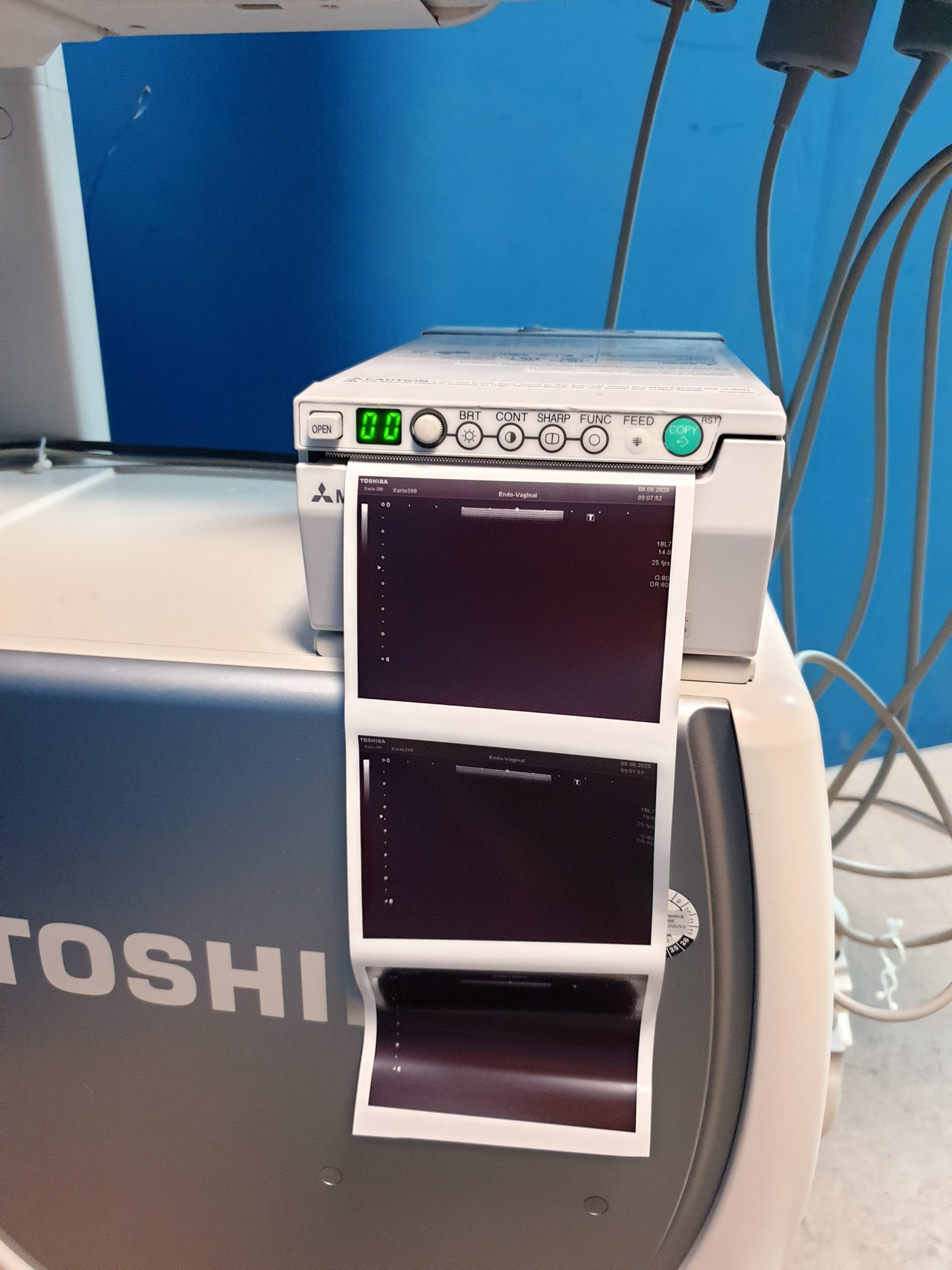 Toshiba TUS-X200 Xario 200 + 6C1 + 11C3 + 18L7 Konvex Linear Endovaginal – DOM2015 thumbnail 15