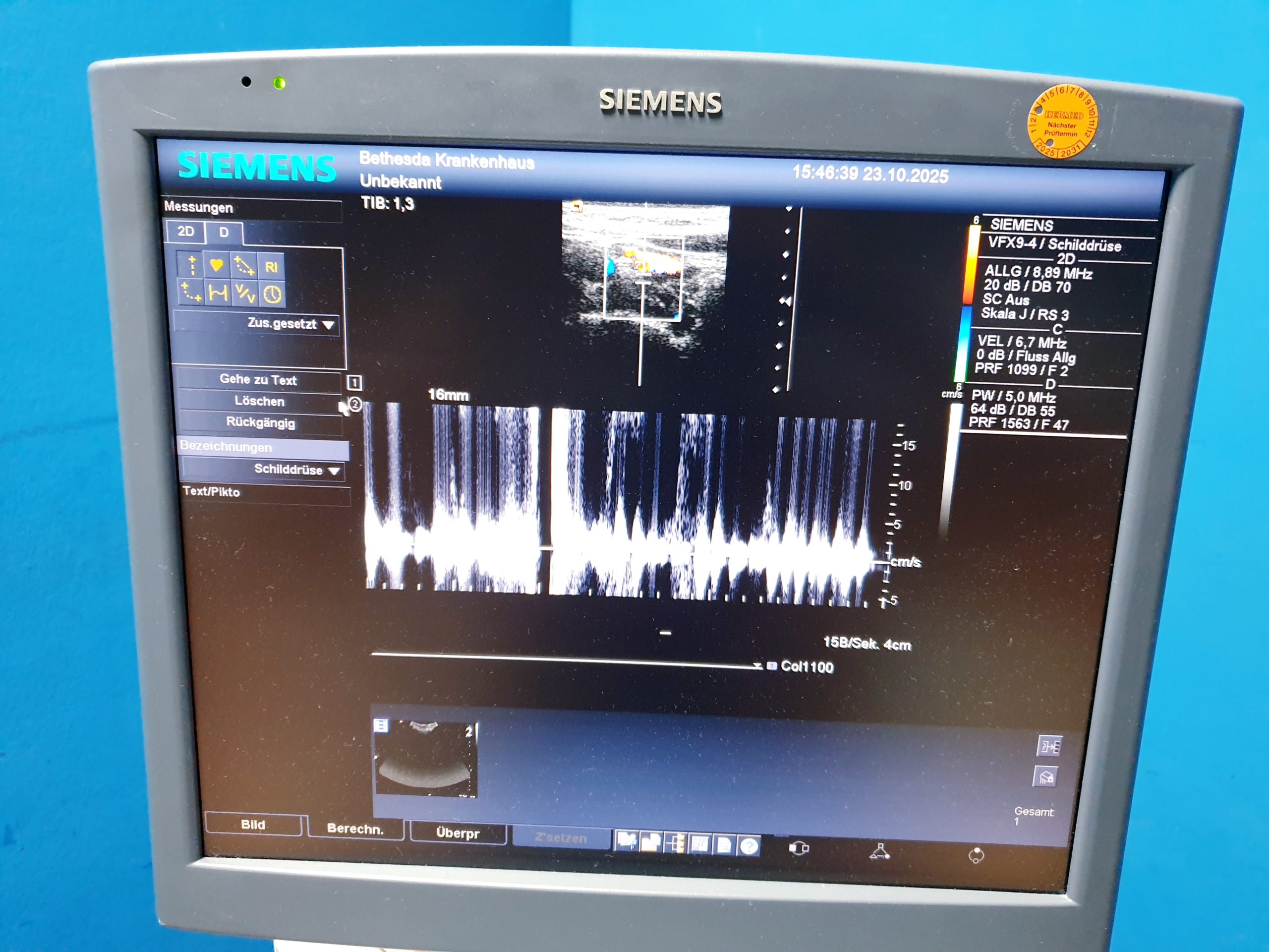 Siemens Acuson Antares Ultraschall Gerät mit 3 Sonden CH4-1 + PX4-1 + VFX9-4 thumbnail 4