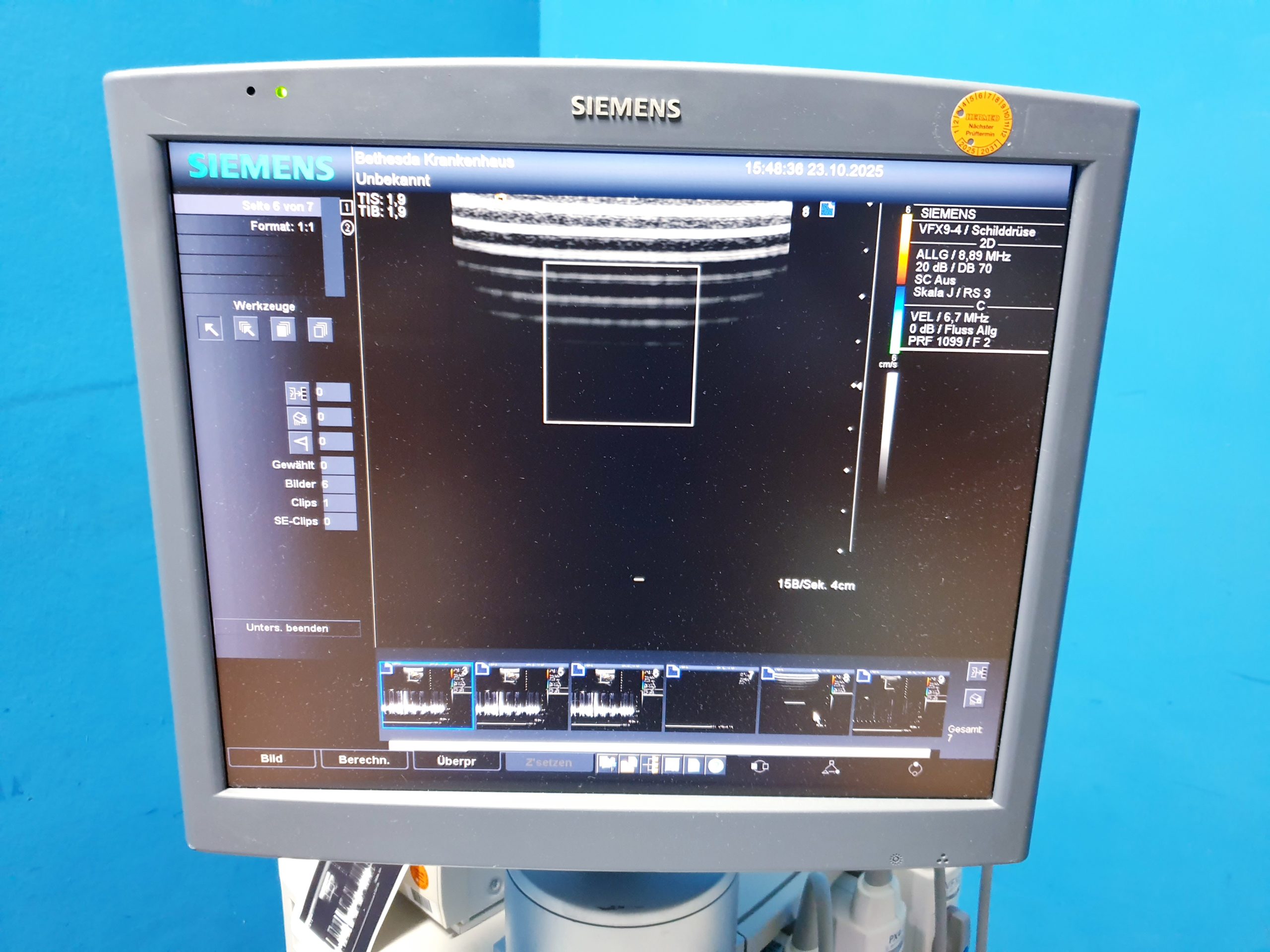 Siemens Acuson Antares Ultraschall Gerät mit 3 Sonden CH4-1 + PX4-1 + VFX9-4 thumbnail 6