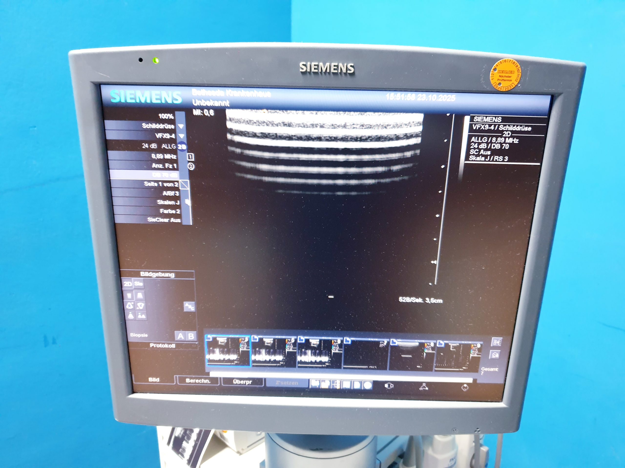 Siemens Acuson Antares Ultraschall Gerät mit 3 Sonden CH4-1 + PX4-1 + VFX9-4 thumbnail 11