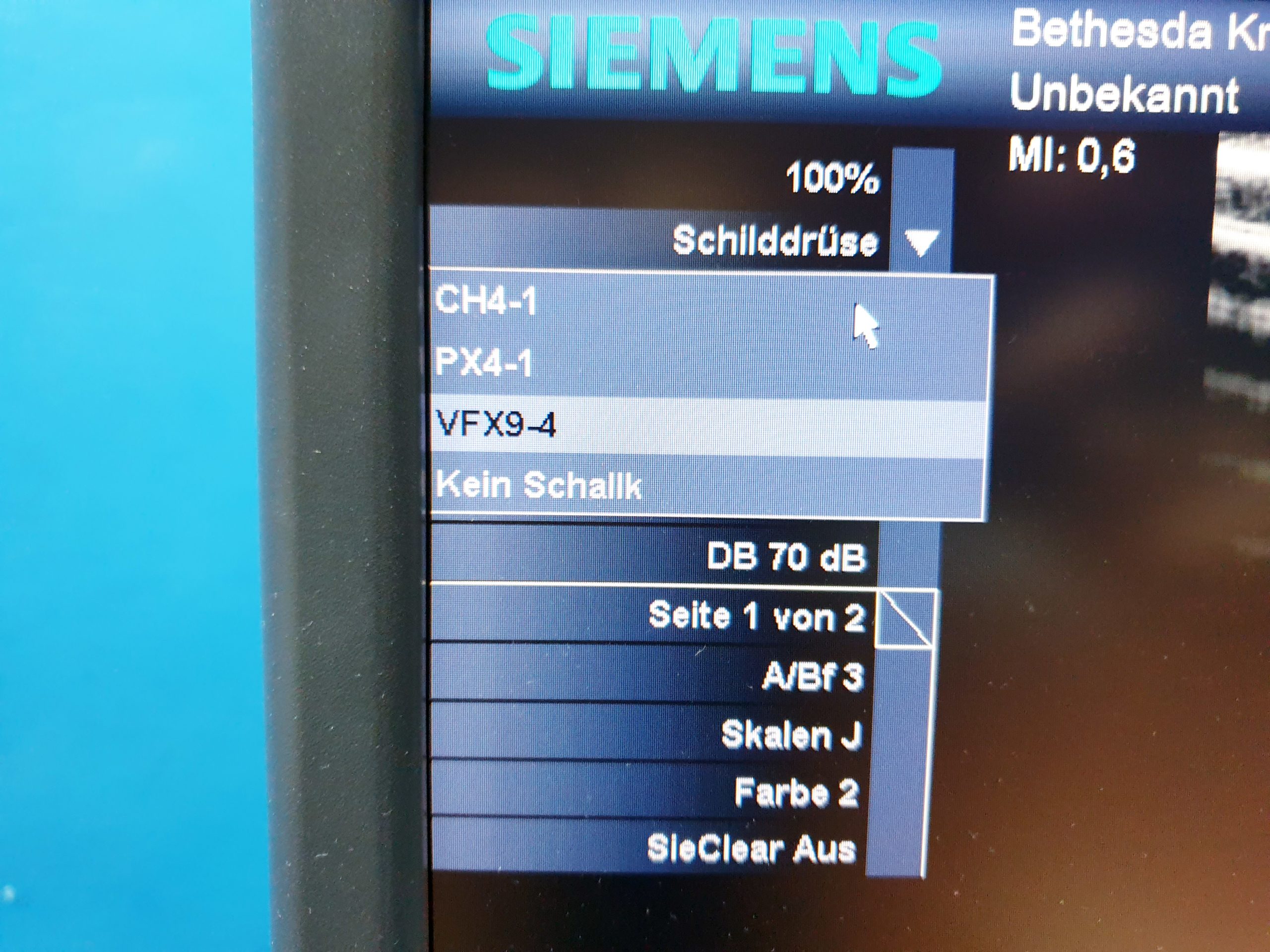 Siemens Acuson Antares Ultraschall Gerät mit 3 Sonden CH4-1 + PX4-1 + VFX9-4 thumbnail 15