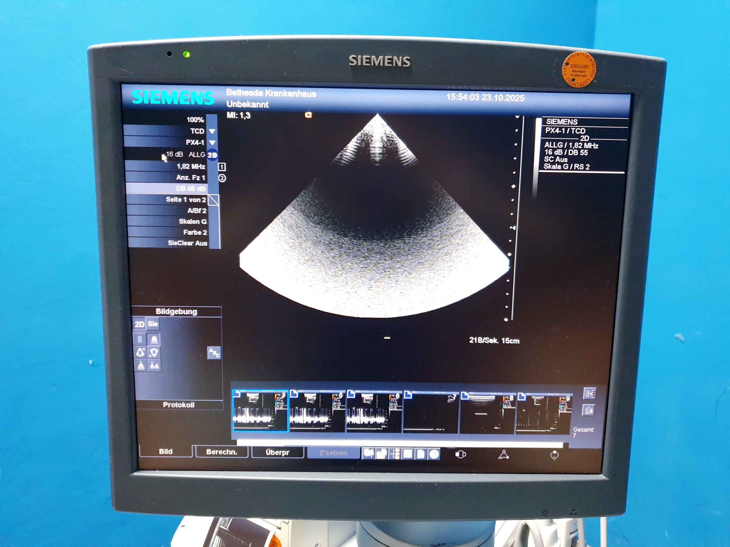 Siemens Acuson Antares Ultraschall Gerät mit 3 Sonden CH4-1 + PX4-1 + VFX9-4 thumbnail 17
