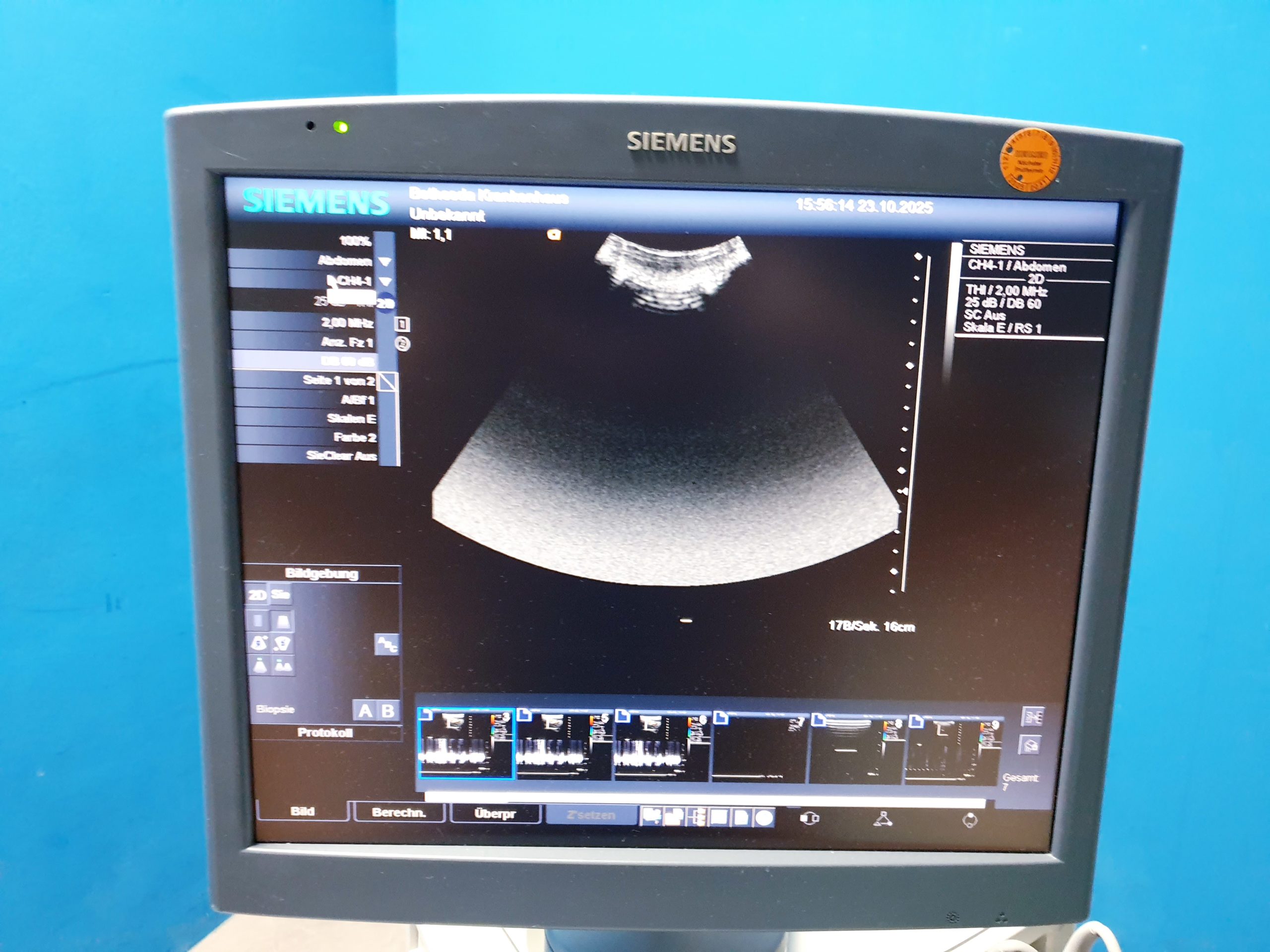 Siemens Acuson Antares Ultraschall Gerät mit 3 Sonden CH4-1 + PX4-1 + VFX9-4 thumbnail 21