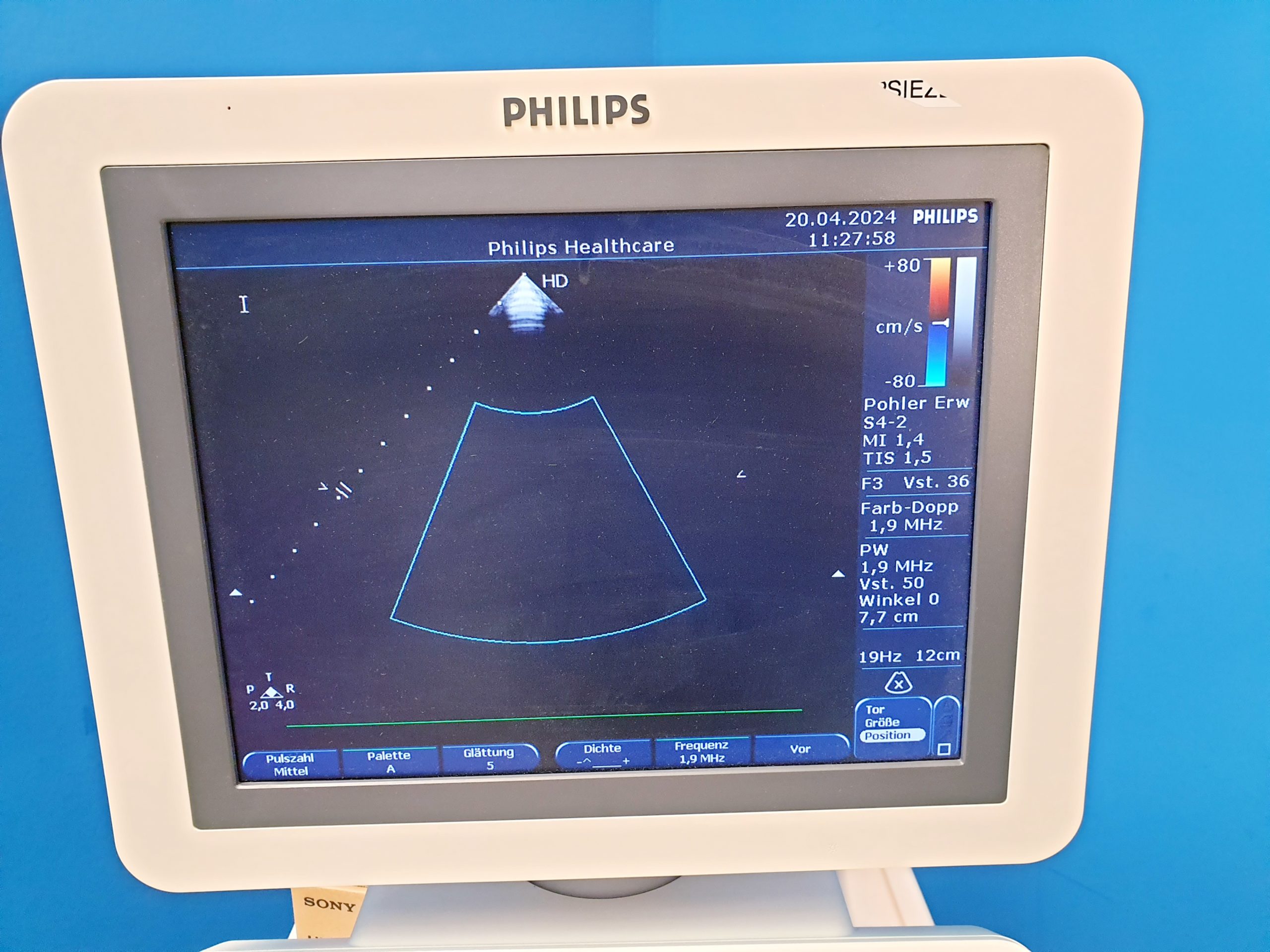 Philips HD7 XE Ultraschallgerät + S4-2 Echo Sonde + L12-5 Linear – Kardio- Doppler – Farbdoppler thumbnail 3