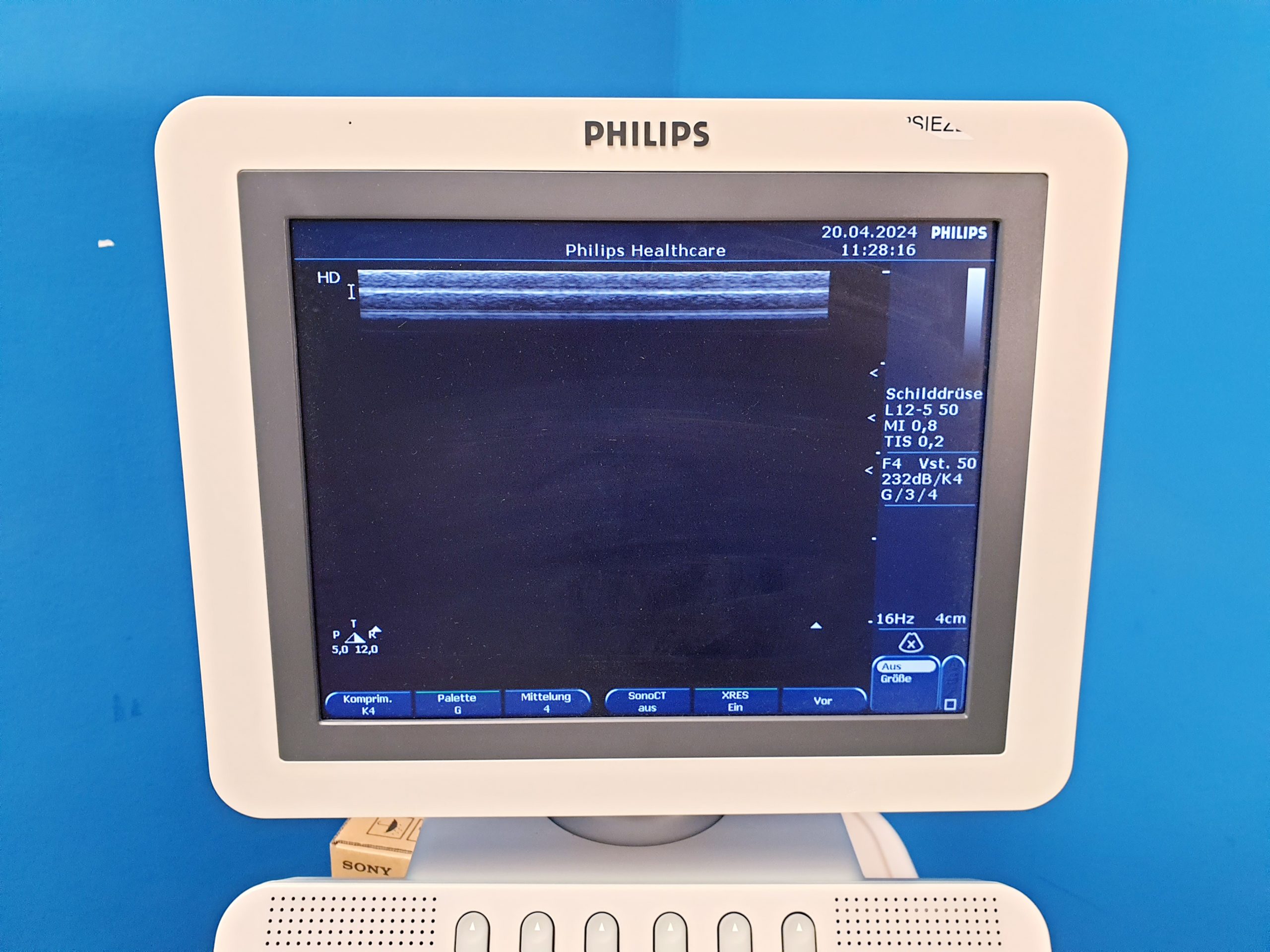 Philips HD7 XE Ultraschallgerät + S4-2 Echo Sonde + L12-5 Linear – Kardio- Doppler – Farbdoppler thumbnail 5