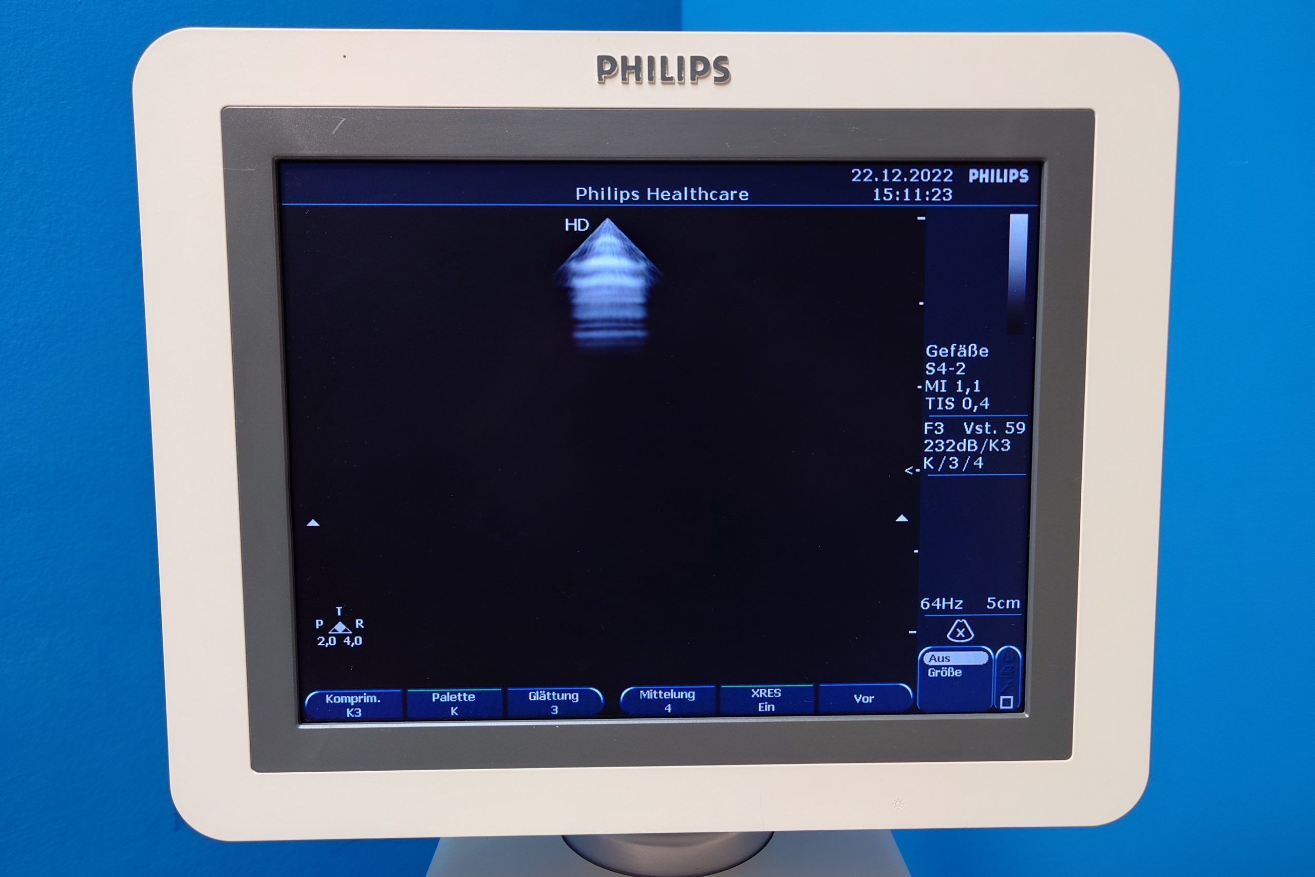 Philips HD7XE // HD 7 XE // HD7 XE – L12-3 + C6-3 + S4-2 Kardiomaschine DOM2010 thumbnail 2