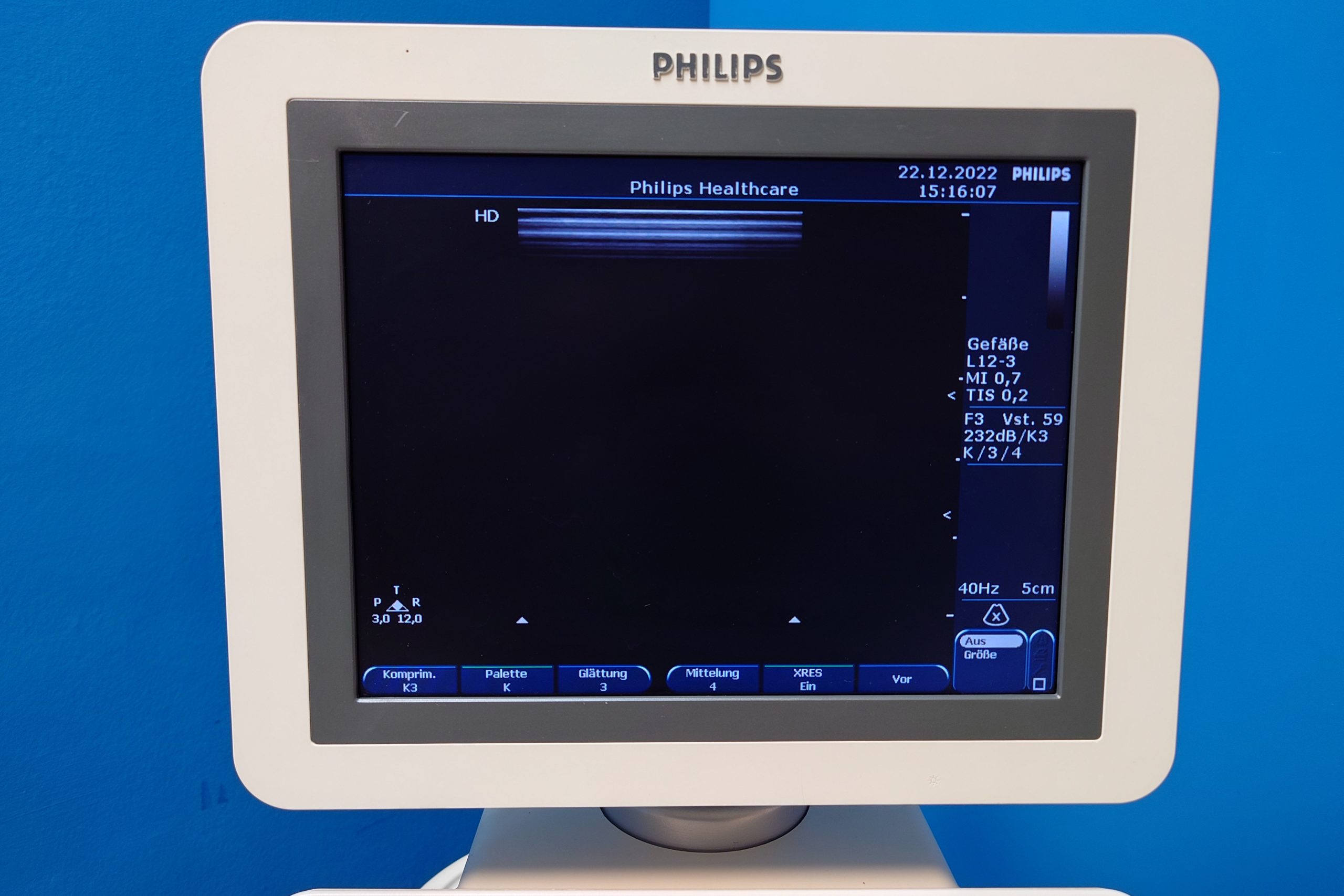 Philips HD7XE // HD 7 XE // HD7 XE – L12-3 + C6-3 + S4-2 Kardiomaschine DOM2010 thumbnail 5