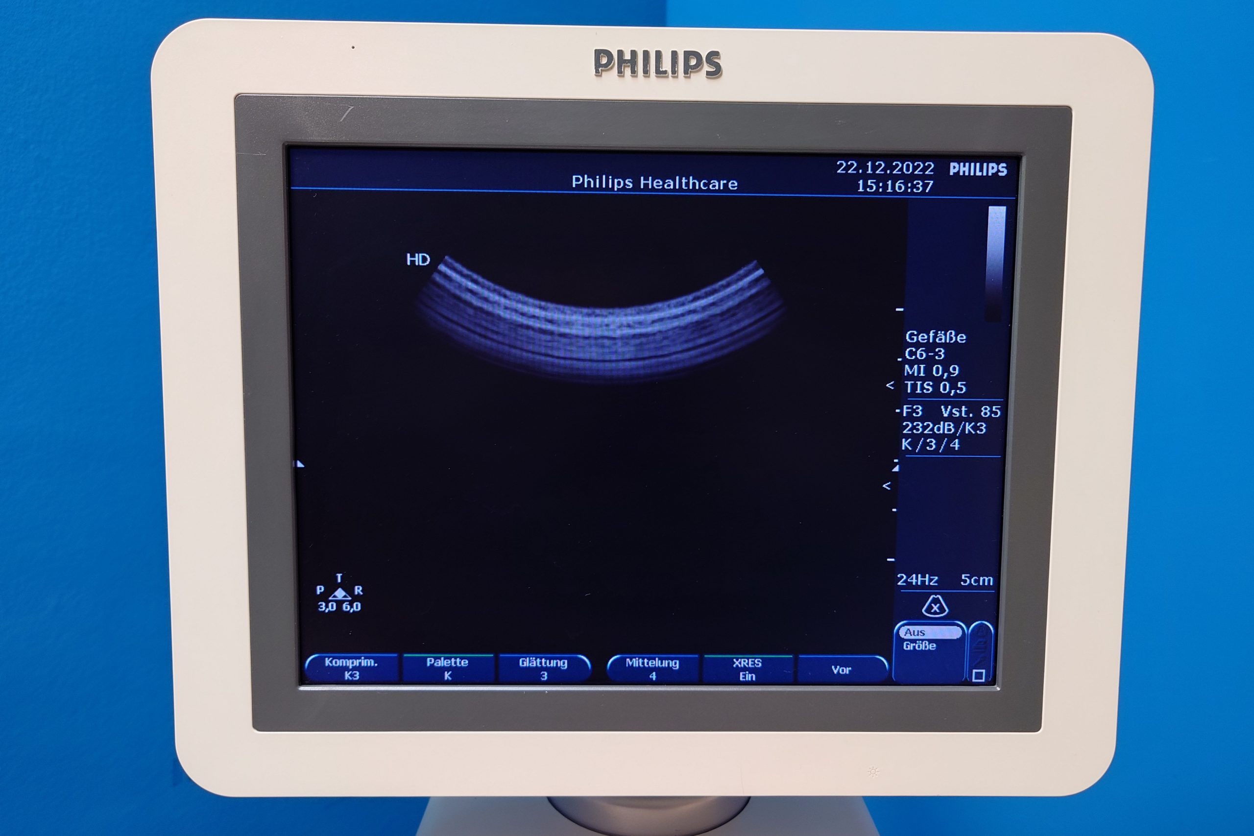 Philips HD7XE // HD 7 XE // HD7 XE – L12-3 + C6-3 + S4-2 Kardiomaschine DOM2010 thumbnail 8
