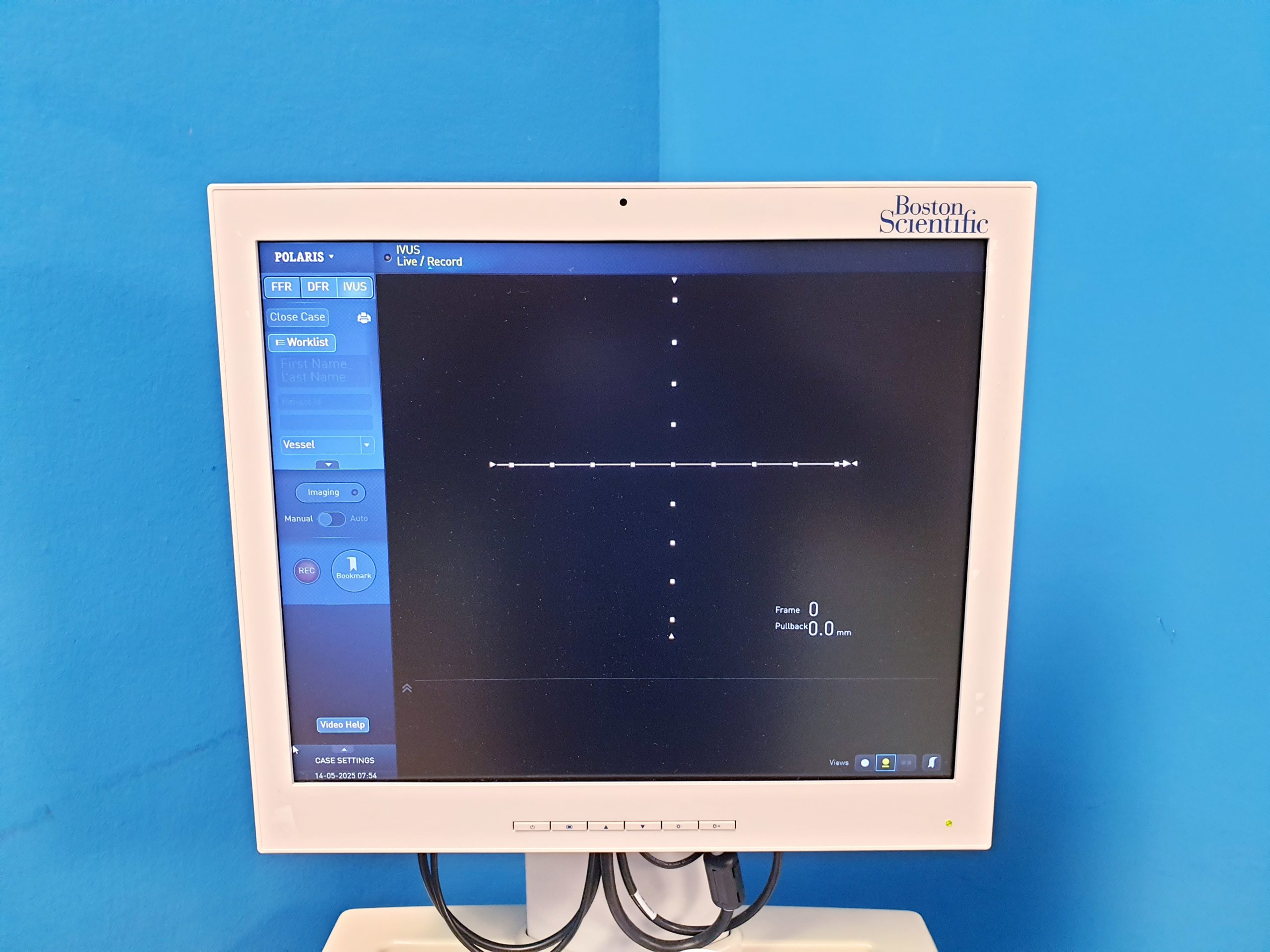Boston Scientific iLab Ultrasound Imaging System thumbnail 6