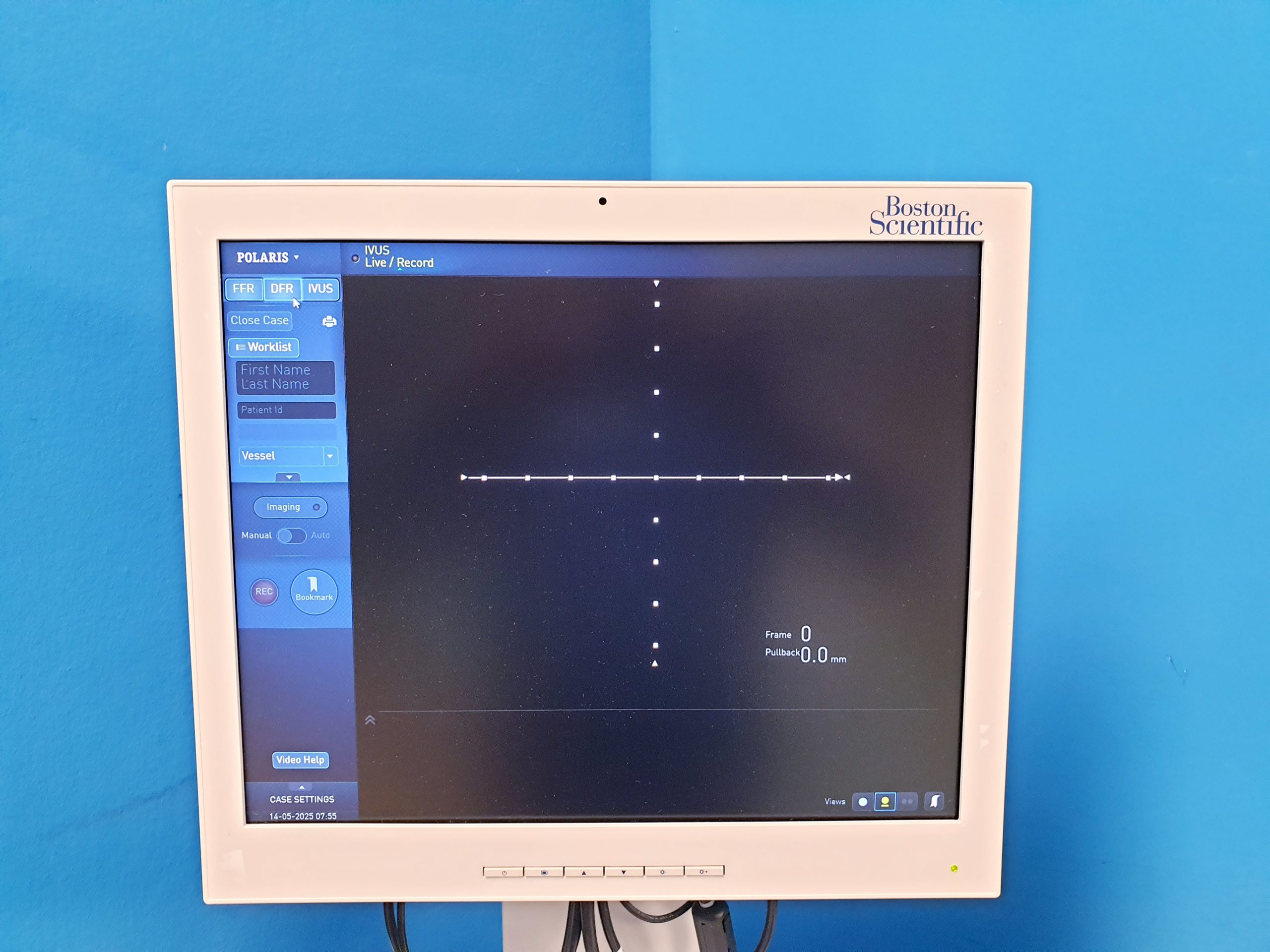 Boston Scientific iLab Ultrasound Imaging System thumbnail 9