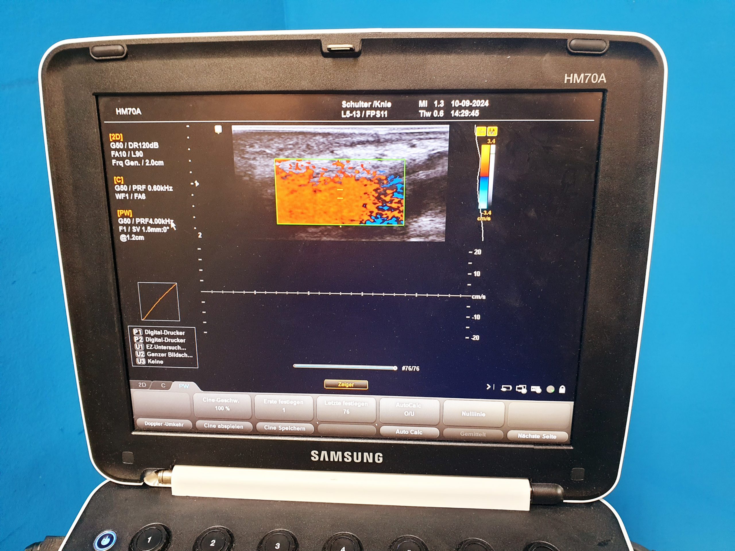 Samsung HM70A + L5-13 Linear Sonde + …. DOM 2015 — image 1 of 19