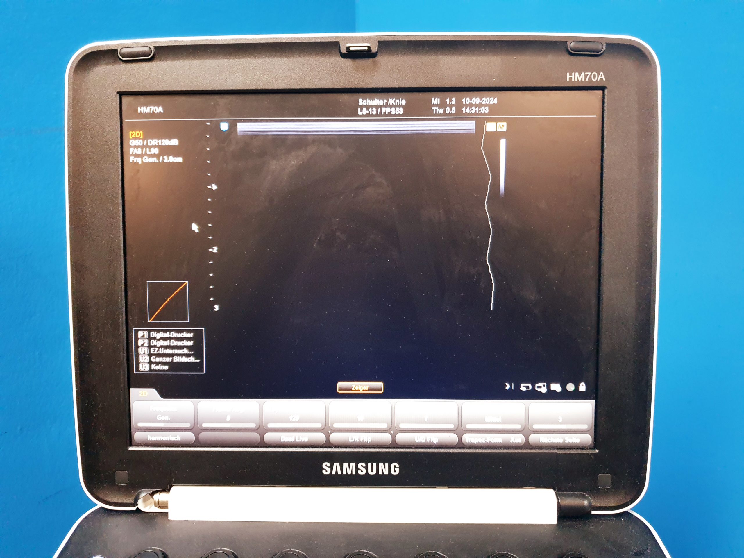 Samsung HM70A + L5-13 Linear Sonde + …. DOM 2015 thumbnail 3