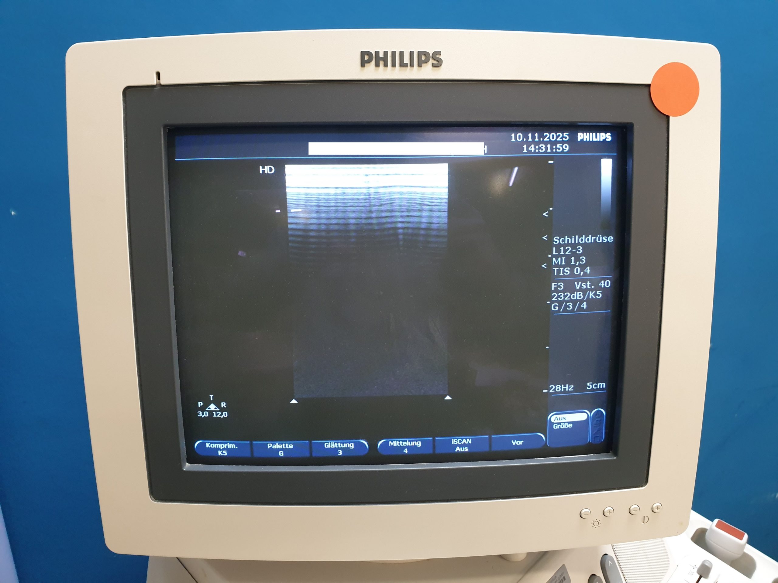 Philips L12-3 Linear Sonde thumbnail 15