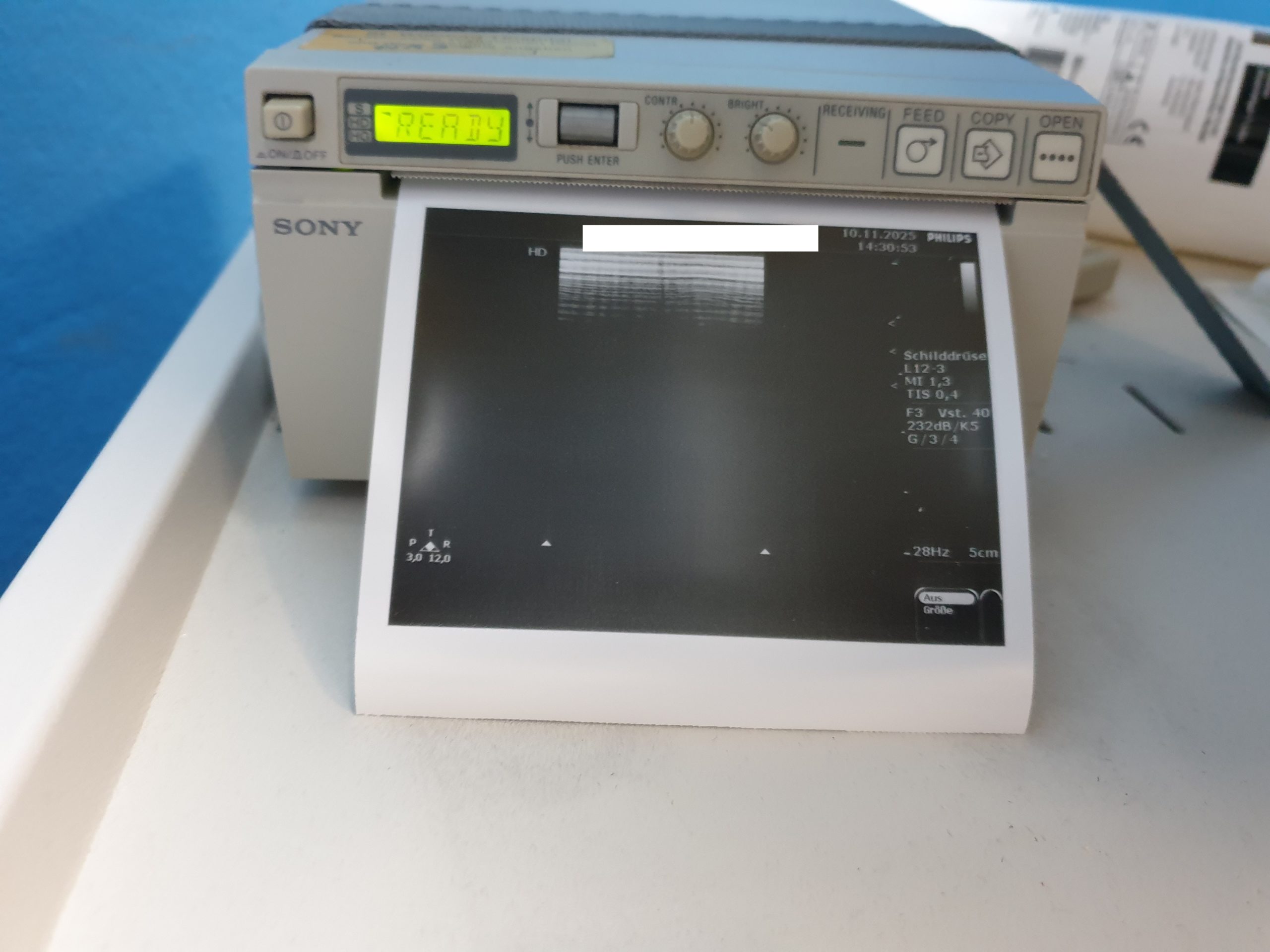 Philips L12-3 Linear Sonde thumbnail 16