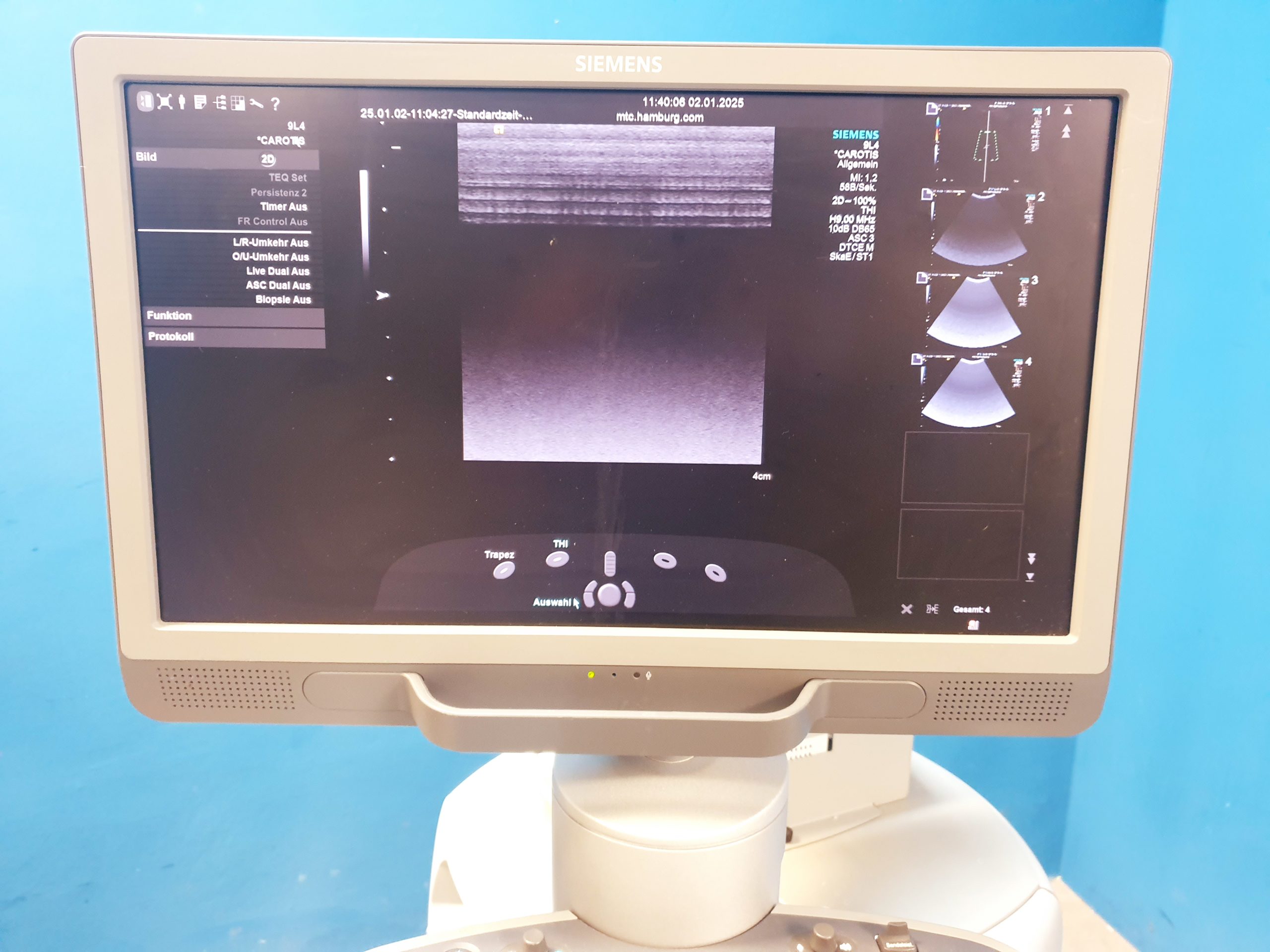 Siemens Acuson 9L4 Linear Sonde thumbnail 4