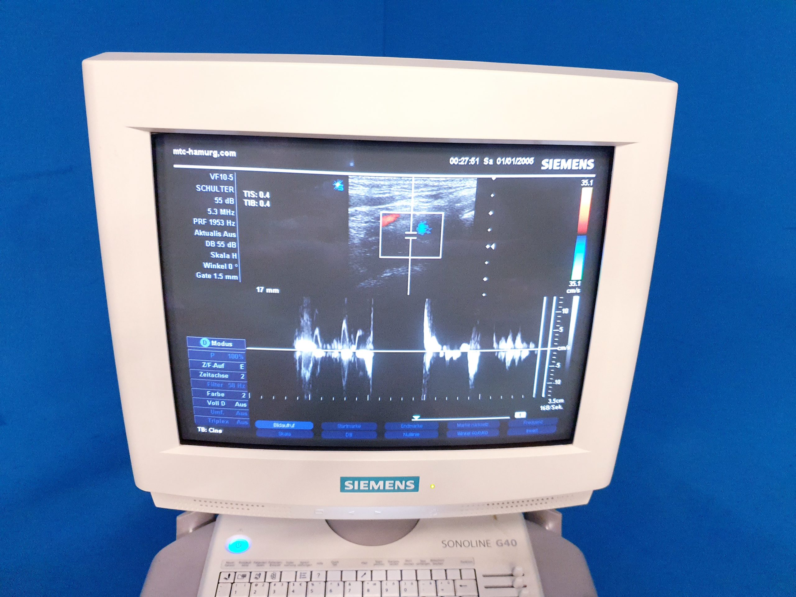 Siemens Sonoline G40 – G 40 Ultraschall +L9-5 linear+ VF10-5 Lineare Sonde thumbnail 3