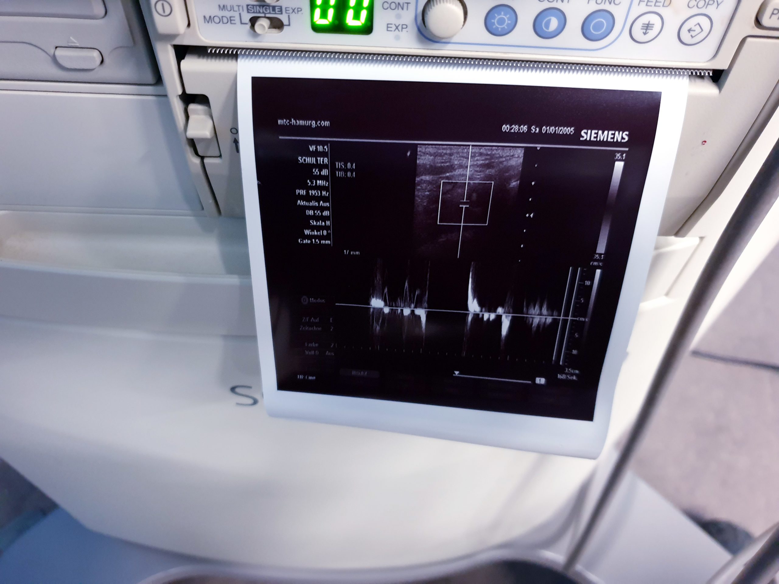 Siemens Sonoline G40 – G 40 Ultraschall +L9-5 linear+ VF10-5 Lineare Sonde thumbnail 4