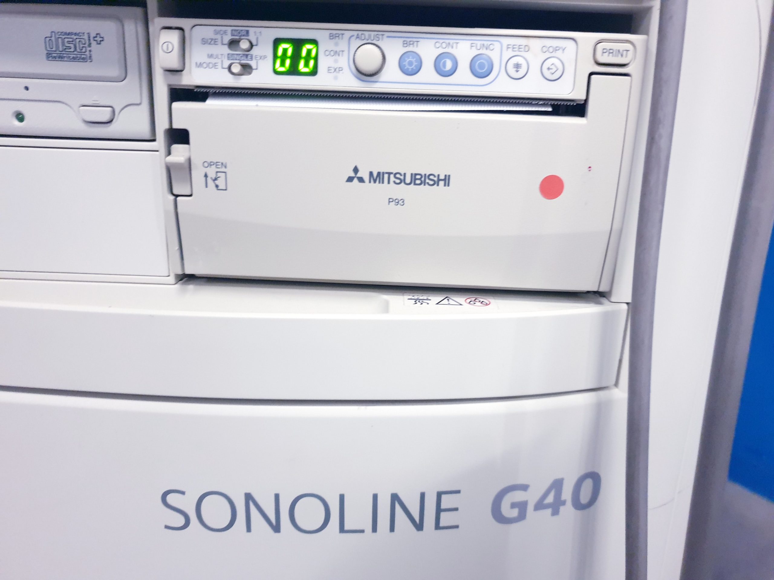 Siemens Sonoline G40 – G 40 Ultraschall +L9-5 linear+ VF10-5 Lineare Sonde thumbnail 12