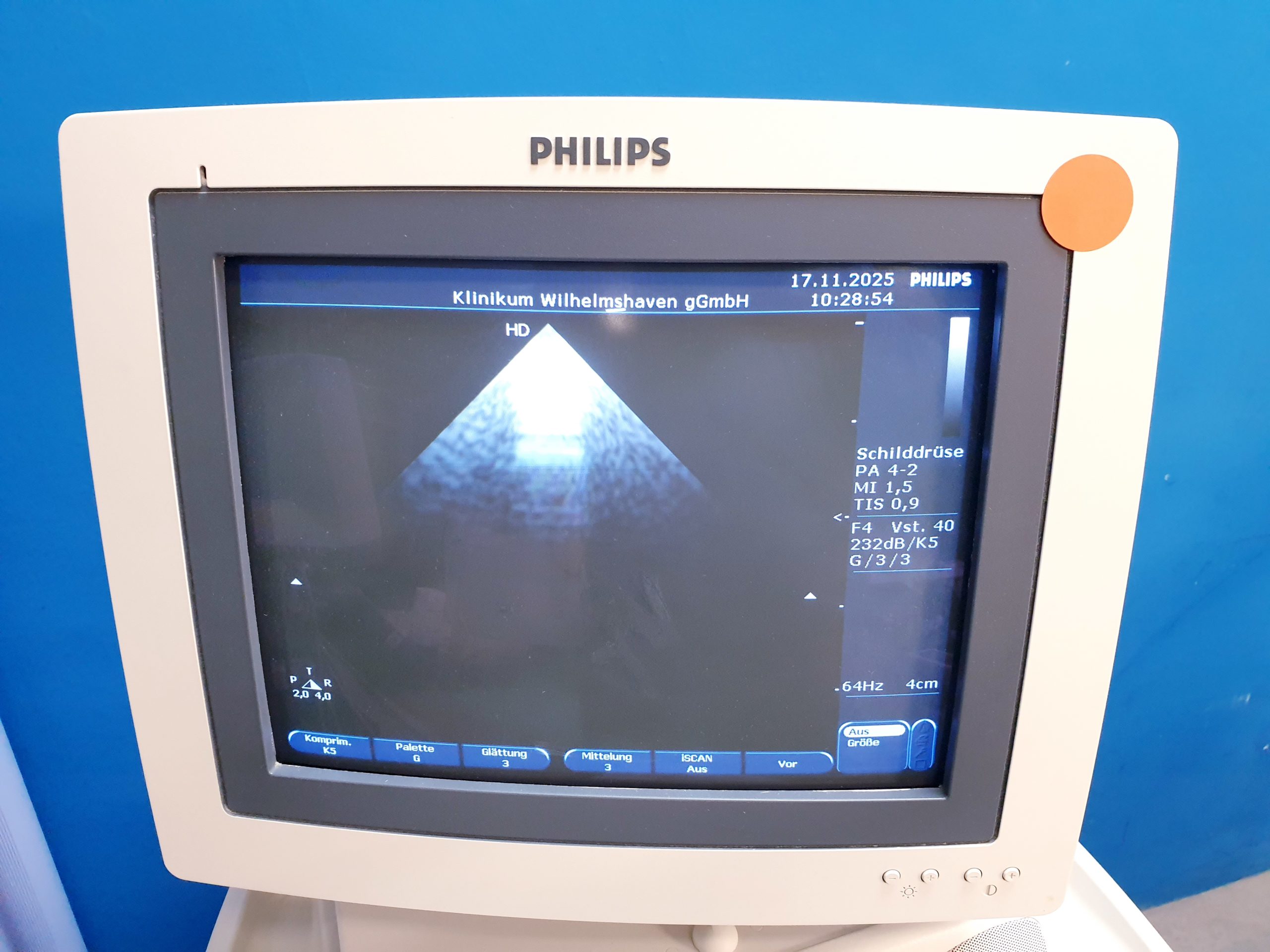 Philips PA4-2 PA 4 2 Ultraschallsonde Phased-Array-Schallkopf – Echosonde thumbnail 2