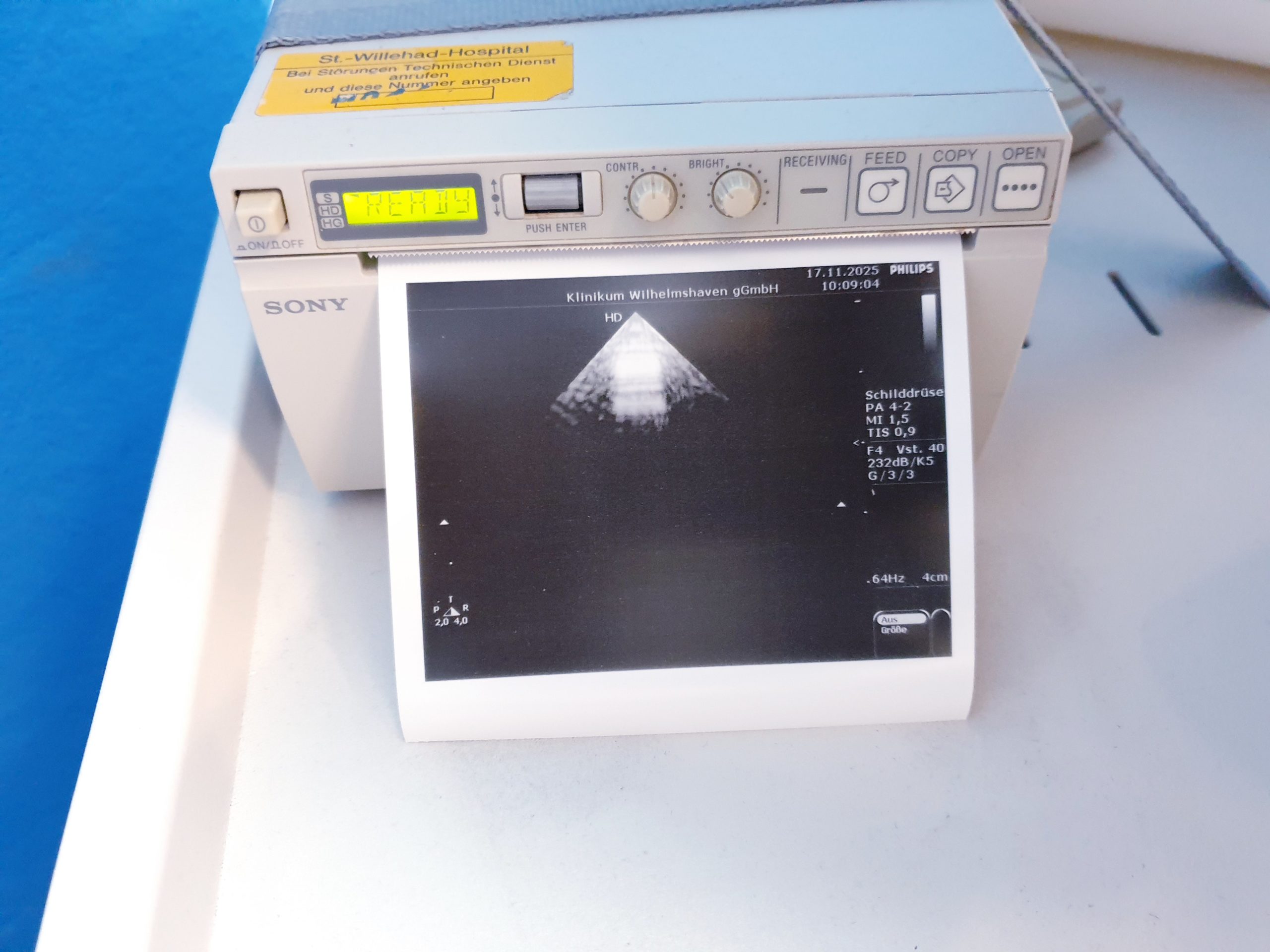 Philips PA4-2 PA 4 2 Ultraschallsonde Phased-Array-Schallkopf – Echosonde thumbnail 4