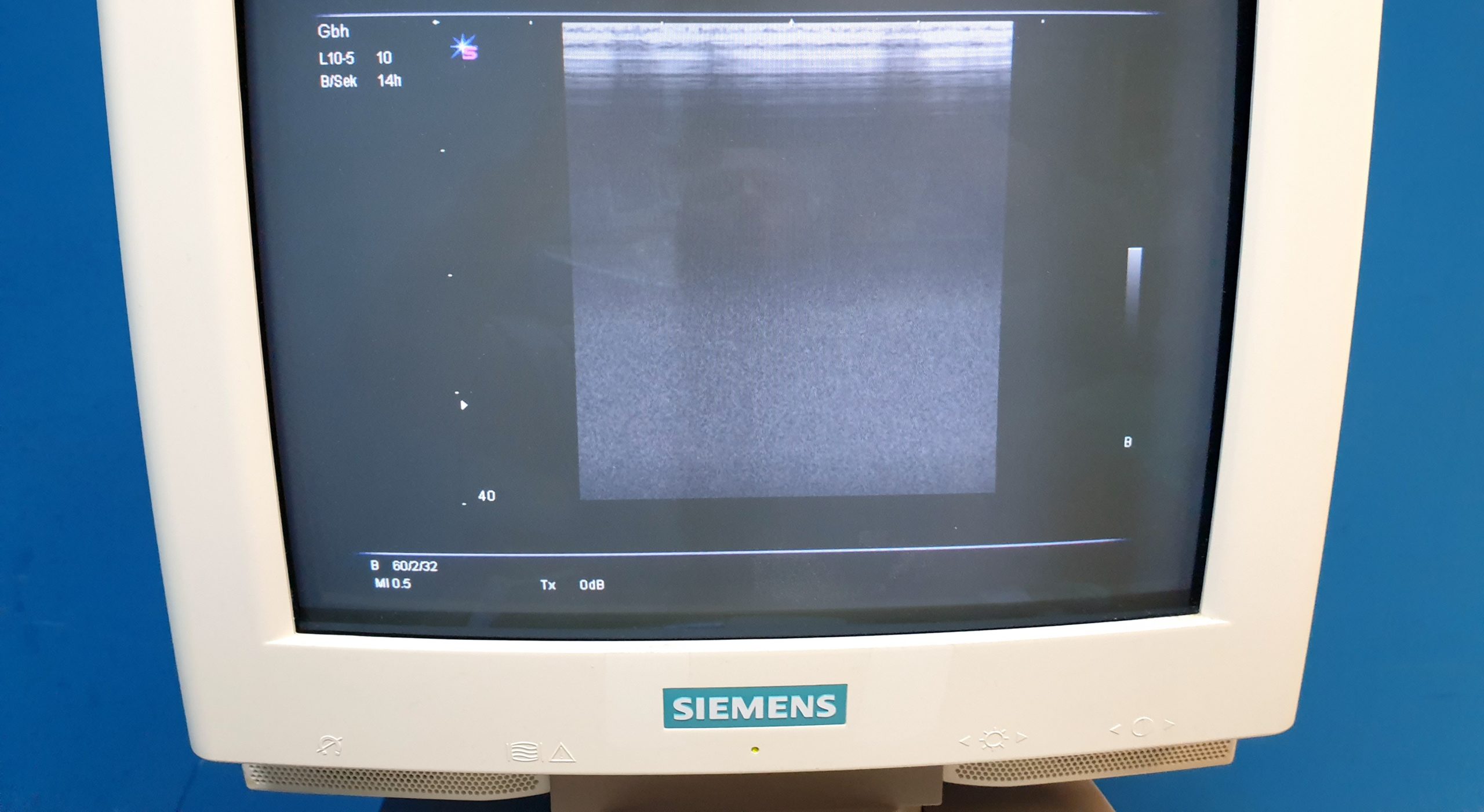 Siemens L10-5 Schallkopf L10-5 (07472660), Ultraschallwandler, Linearsonde thumbnail 4