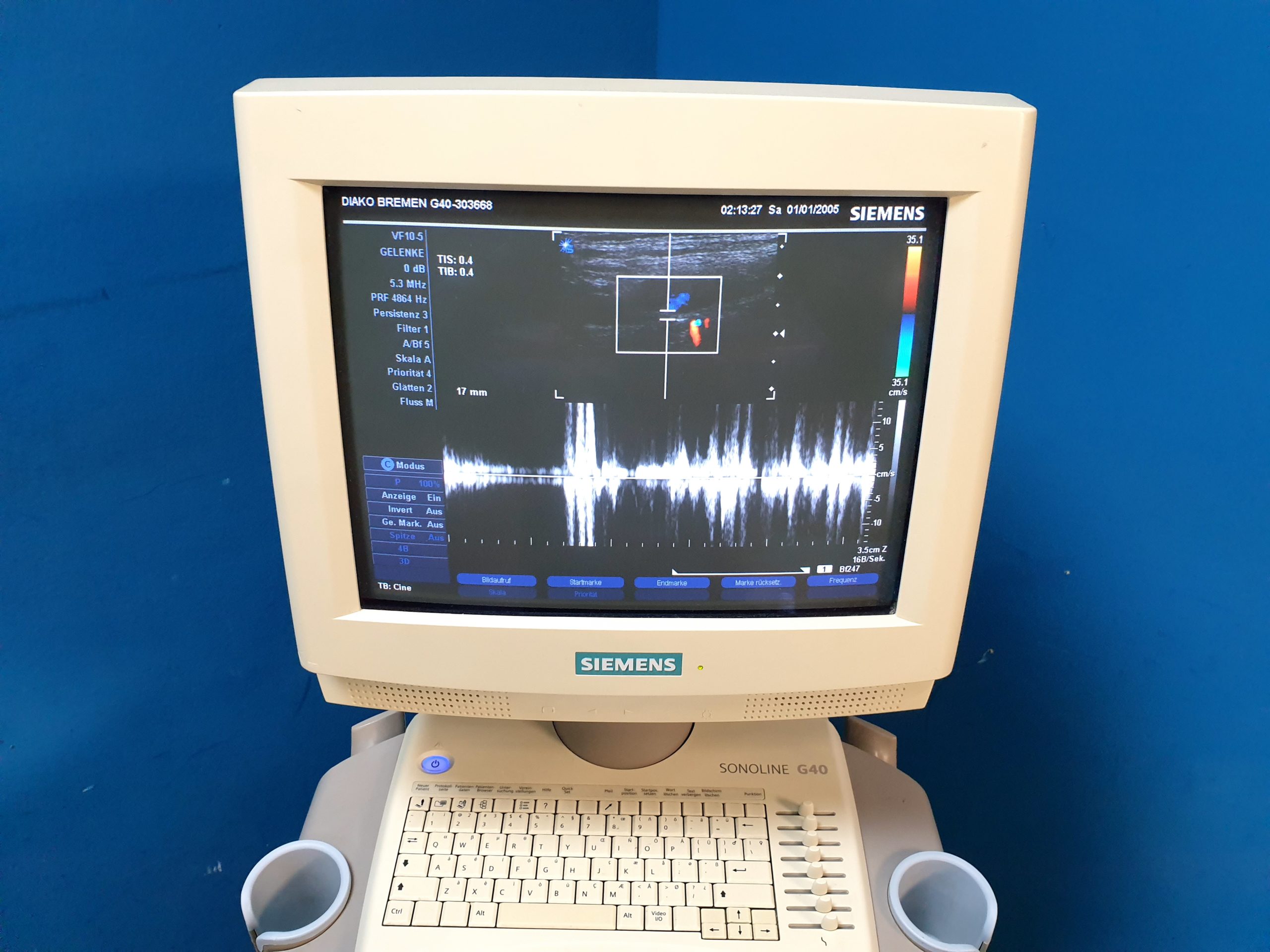 Siemens Sonoline G40 Ultraschallgerät + VF10-5 + L9-5 Sonden – Farbdoppler thumbnail 3