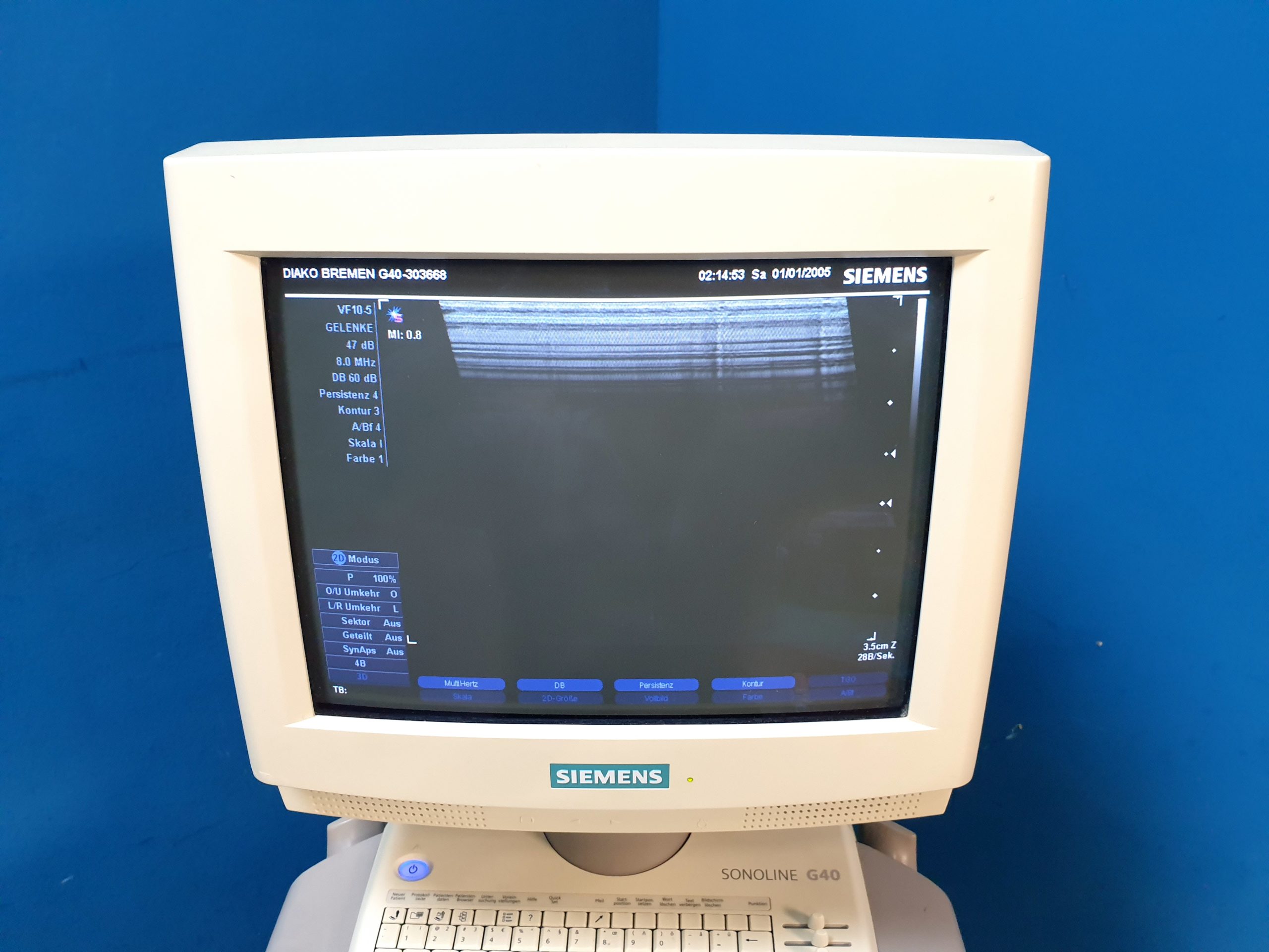 Siemens Sonoline G40 Ultraschallgerät + VF10-5 + L9-5 Sonden – Farbdoppler thumbnail 6