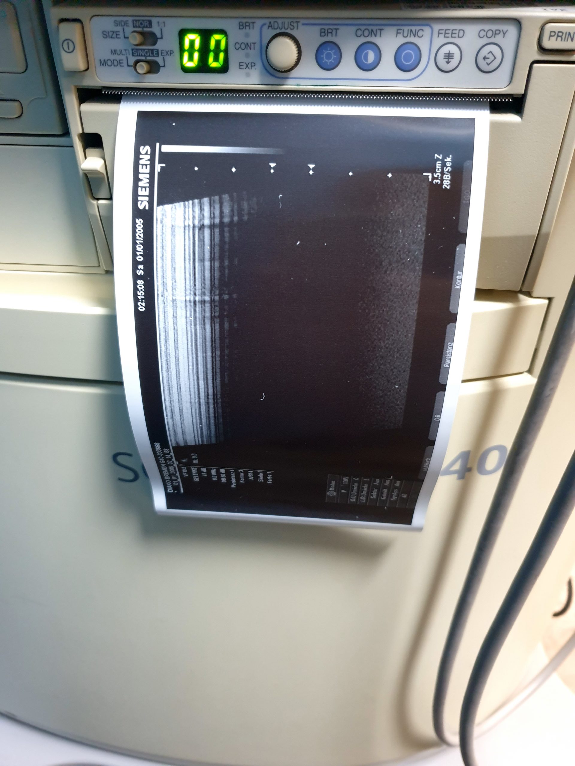 Siemens Sonoline G40 Ultraschallgerät + VF10-5 + L9-5 Sonden – Farbdoppler thumbnail 7