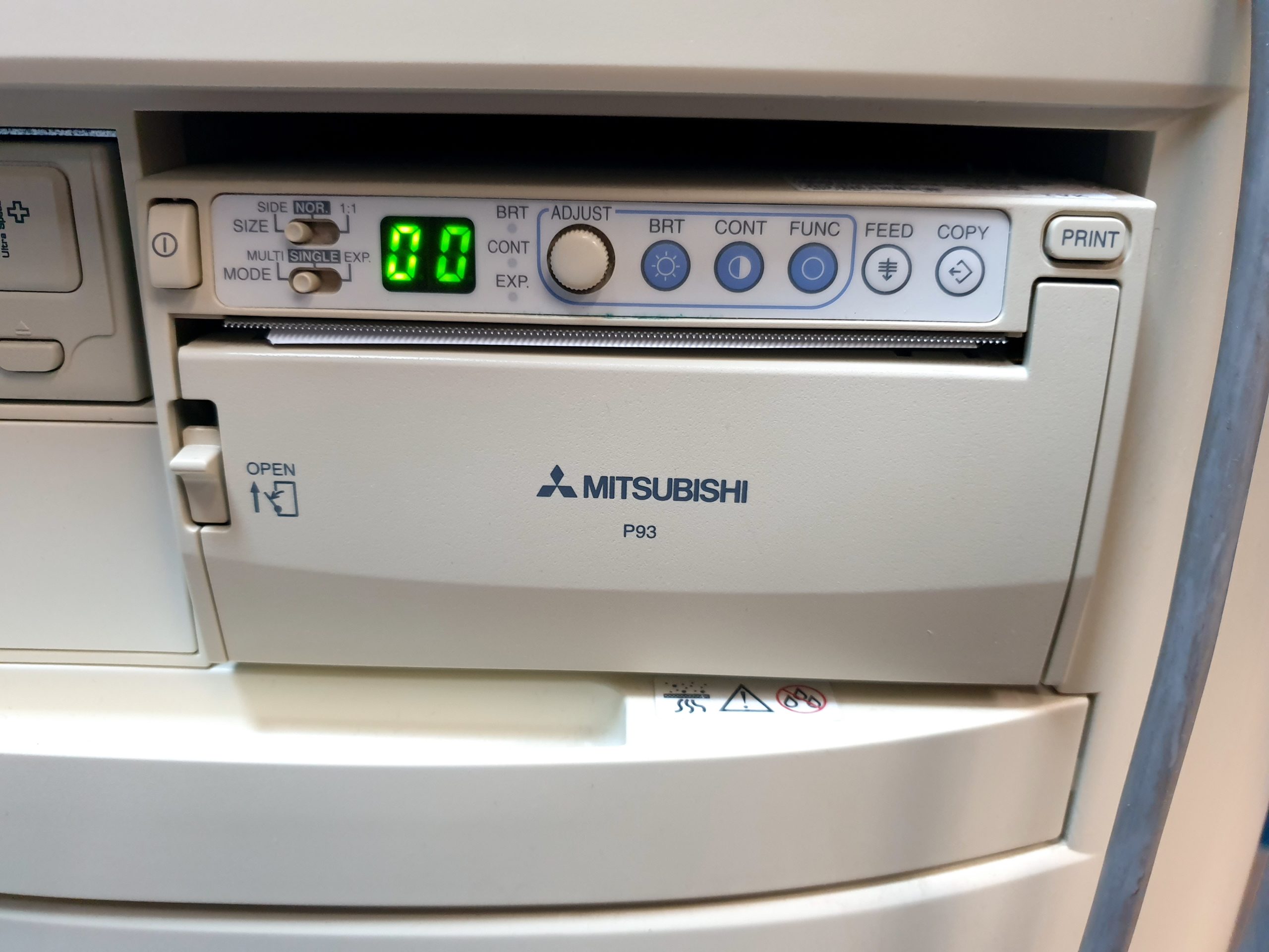 Siemens Sonoline G40 Ultraschallgerät + VF10-5 + L9-5 Sonden – Farbdoppler thumbnail 10