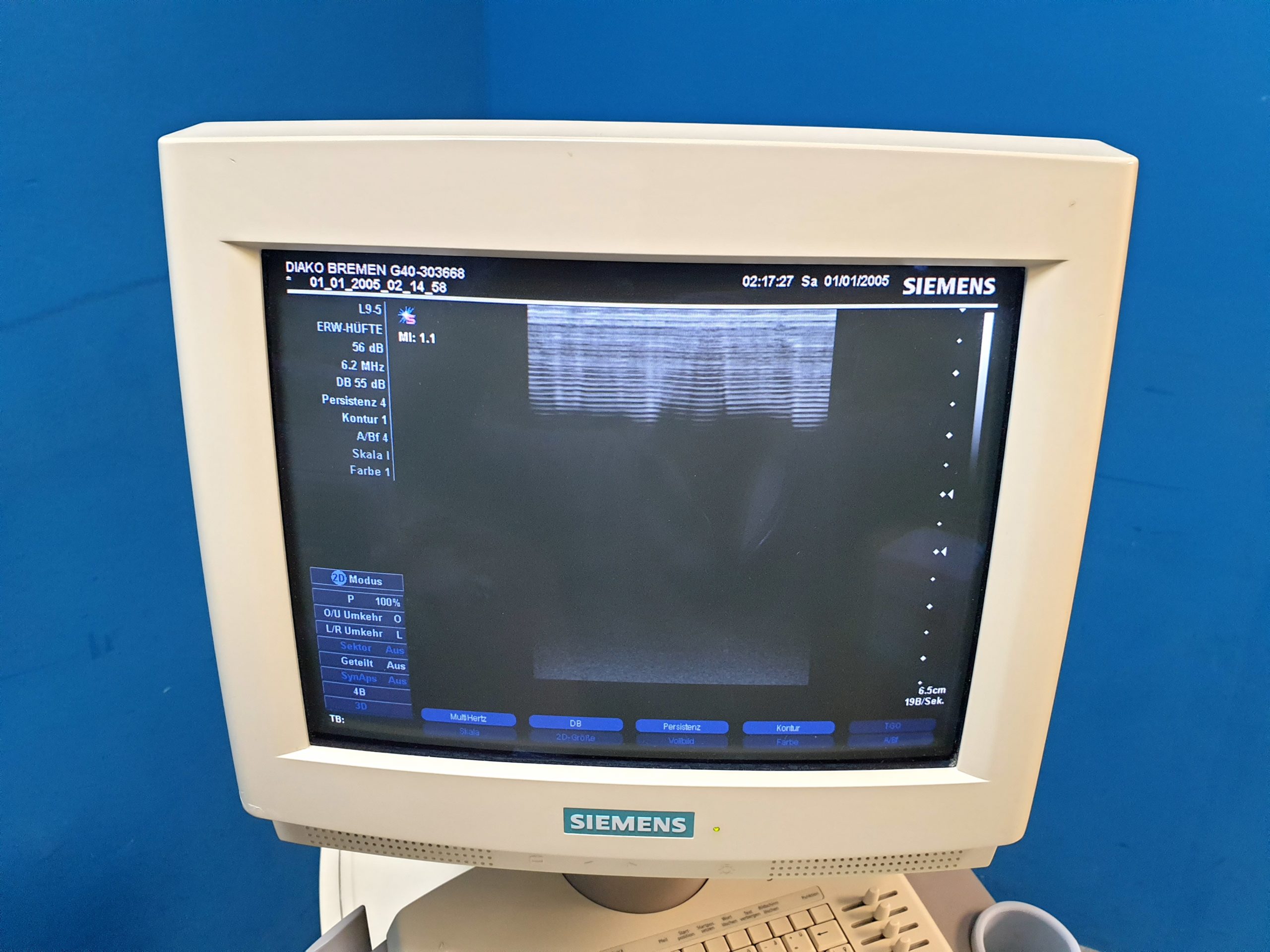 Siemens Sonoline G40 Ultraschallgerät + VF10-5 + L9-5 Sonden – Farbdoppler thumbnail 13