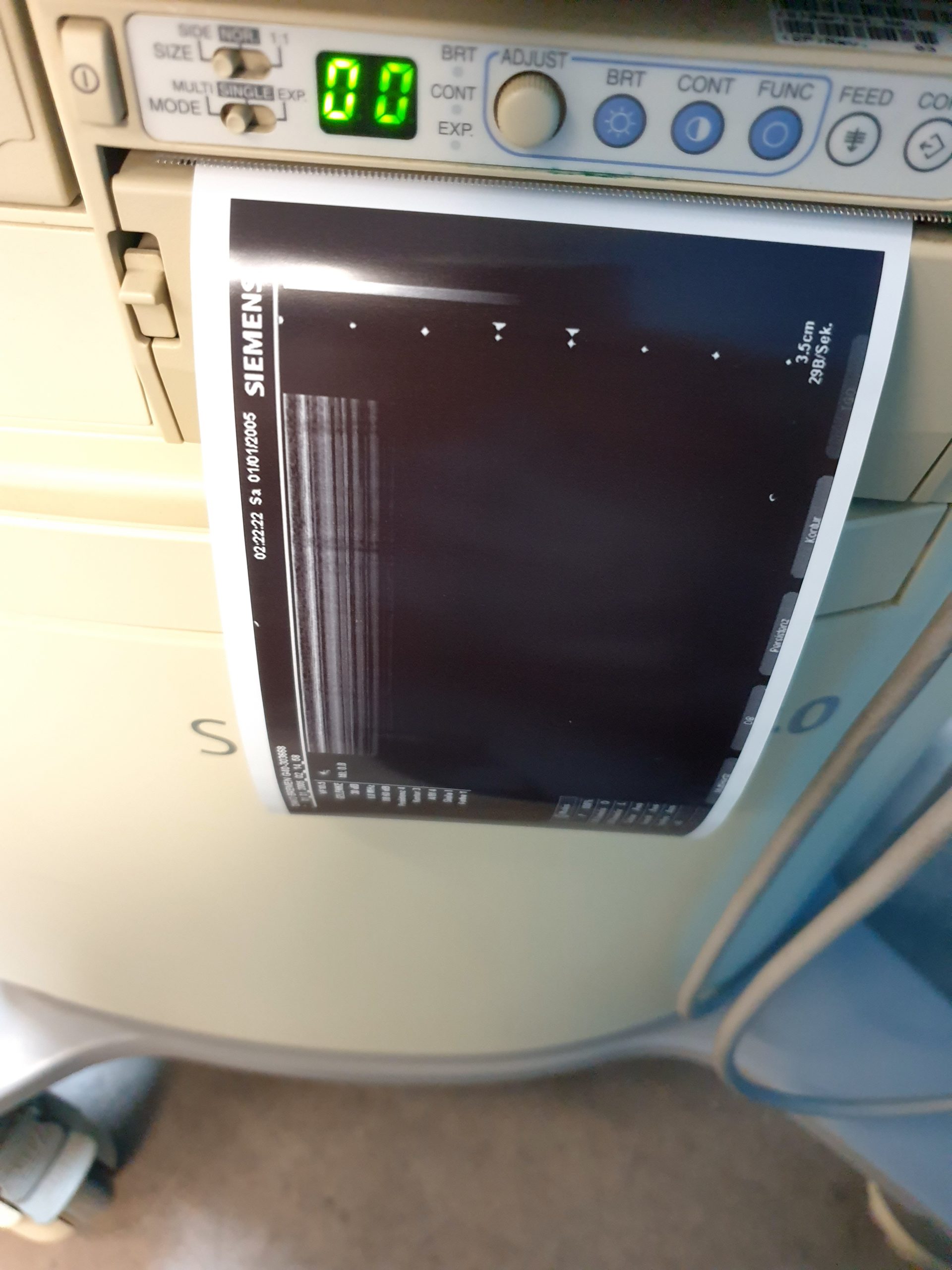 Siemens Sonoline G40 Ultraschallgerät + VF10-5 + L9-5 Sonden – Farbdoppler thumbnail 14