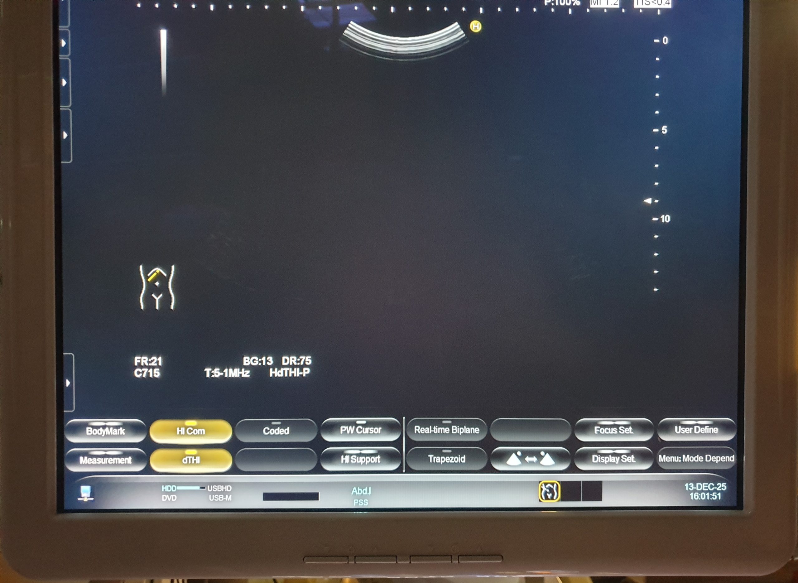 Hitachi EUP-C715 EUPC715 Ultraschall Konvexsonde thumbnail 8