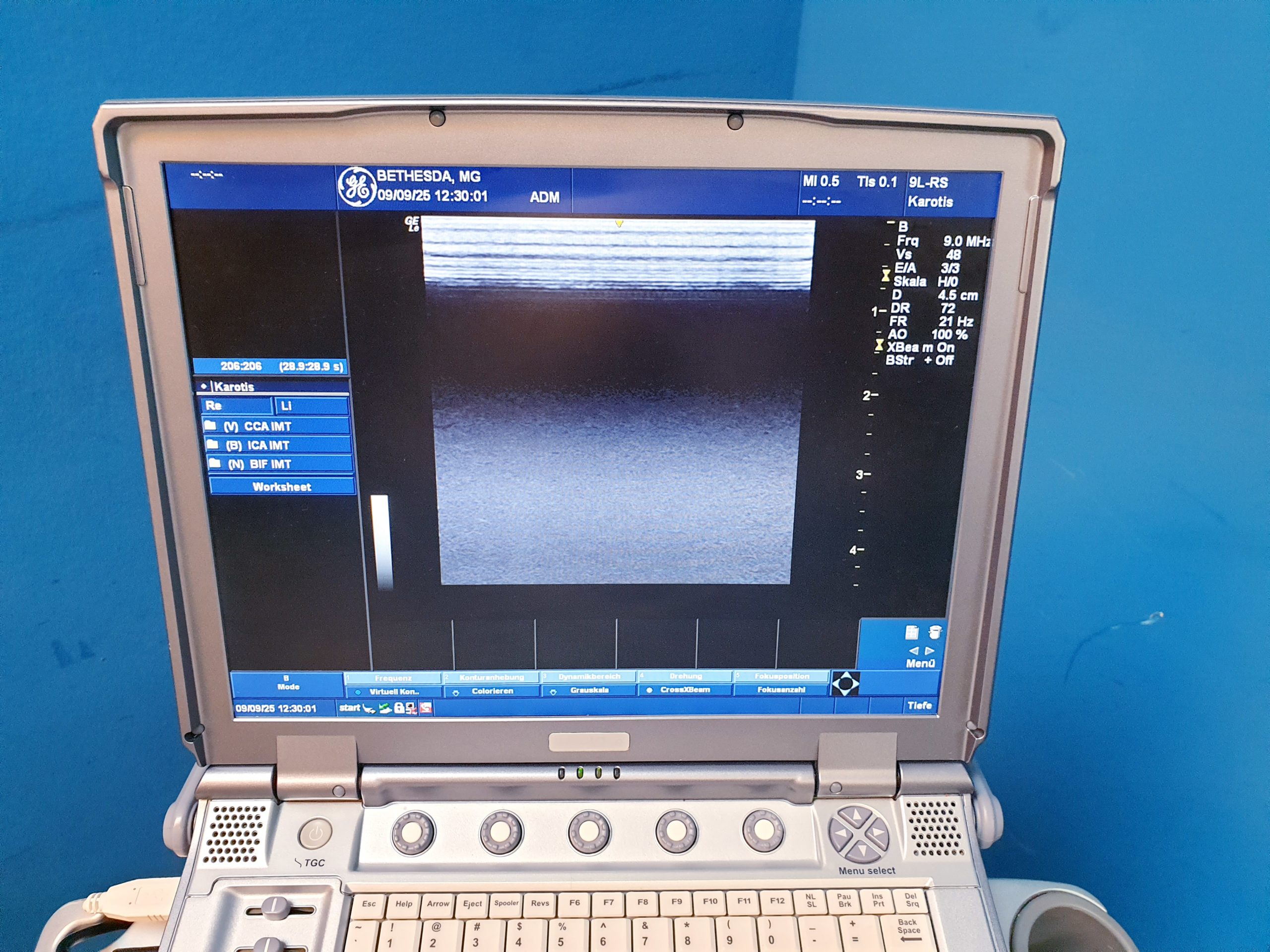 GE 9L RS REF 5212630 Ultrasound Transducer thumbnail 4