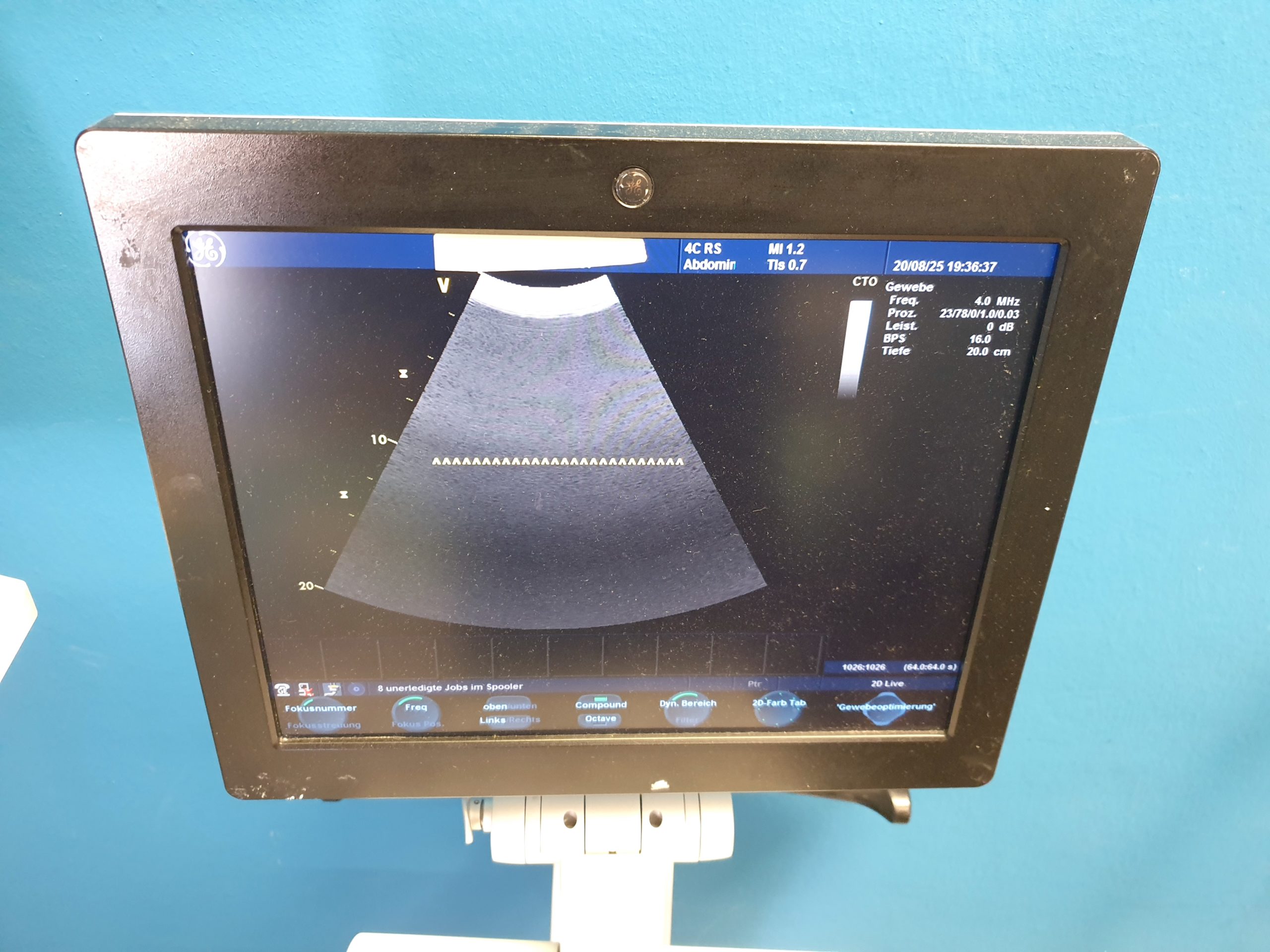 GE 4C-RS Convex Konvex Ultrasound Transducer thumbnail 2