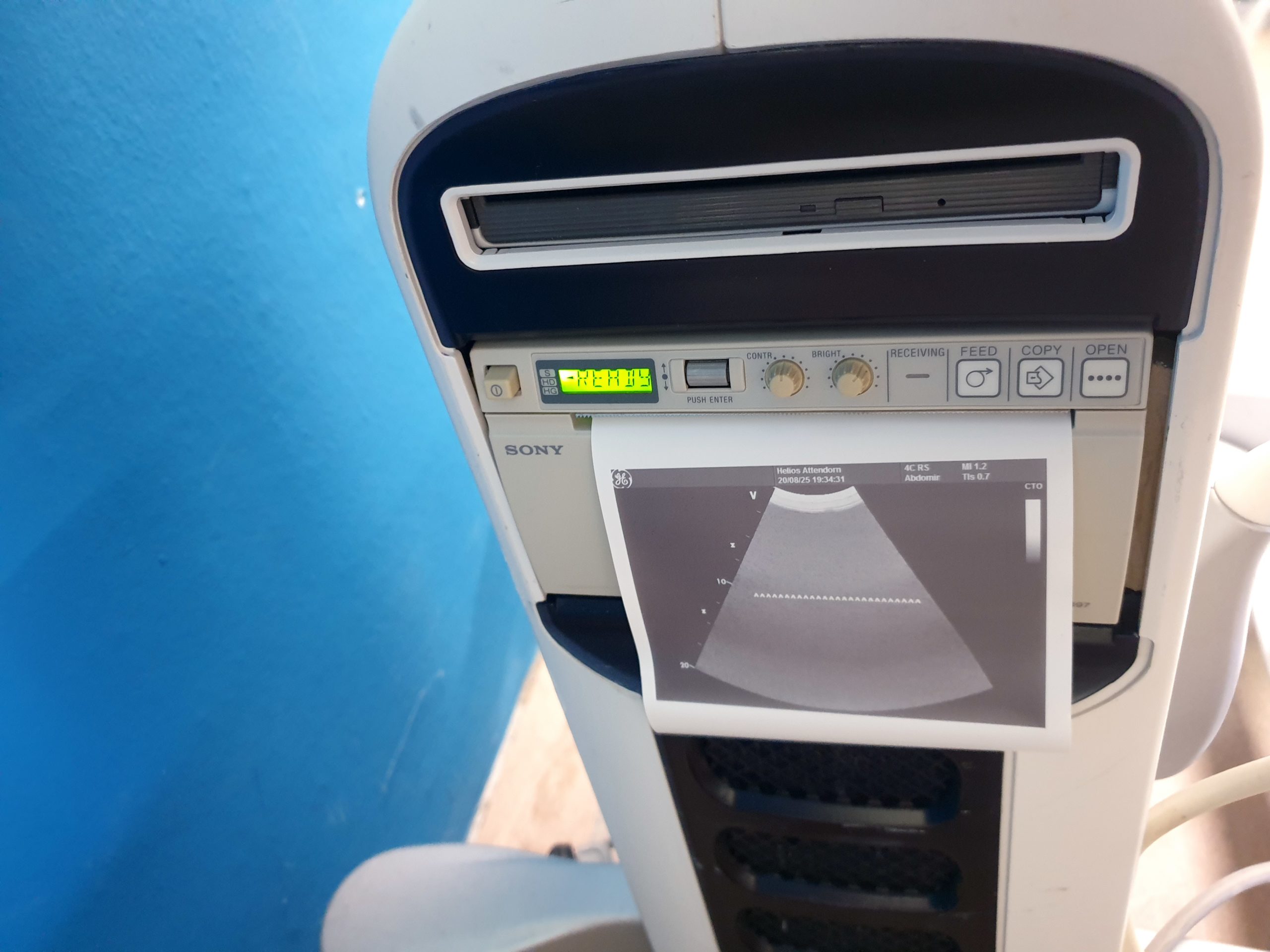 GE 4C-RS Convex Konvex Ultrasound Transducer thumbnail 4