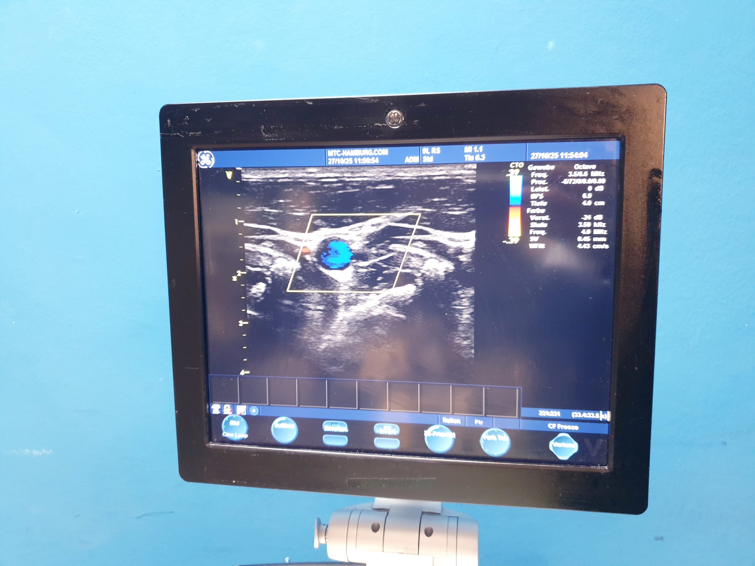 GE Vivid S6 S 6 Ultraschallgerät – Farbdoppler + 9L Linear Sonde Anschlüsse sind defekt thumbnail 6